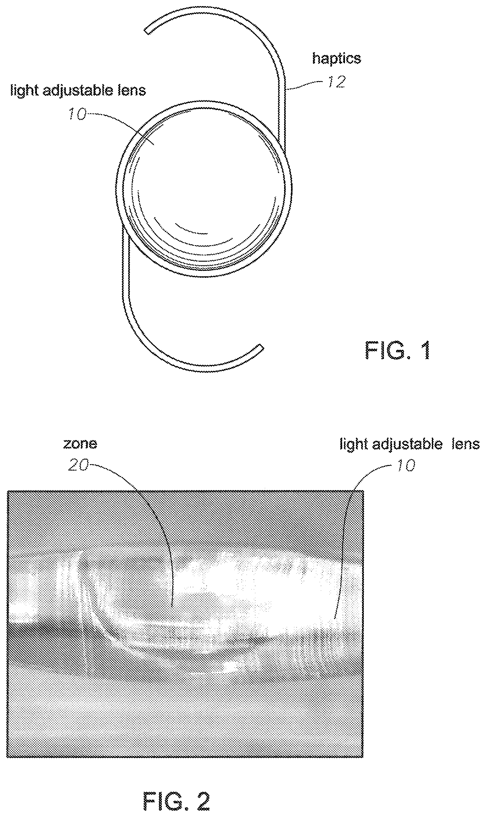 Patent US12102524 — Light adjustable intraocular lens with a modulable absorption front protection layer — Figure 1
