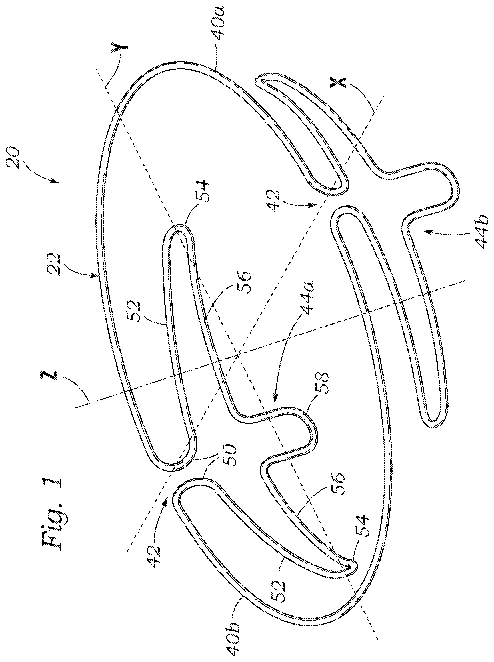 Patent US12102526 — Docking station for heart valve prosthesis — Figure 1