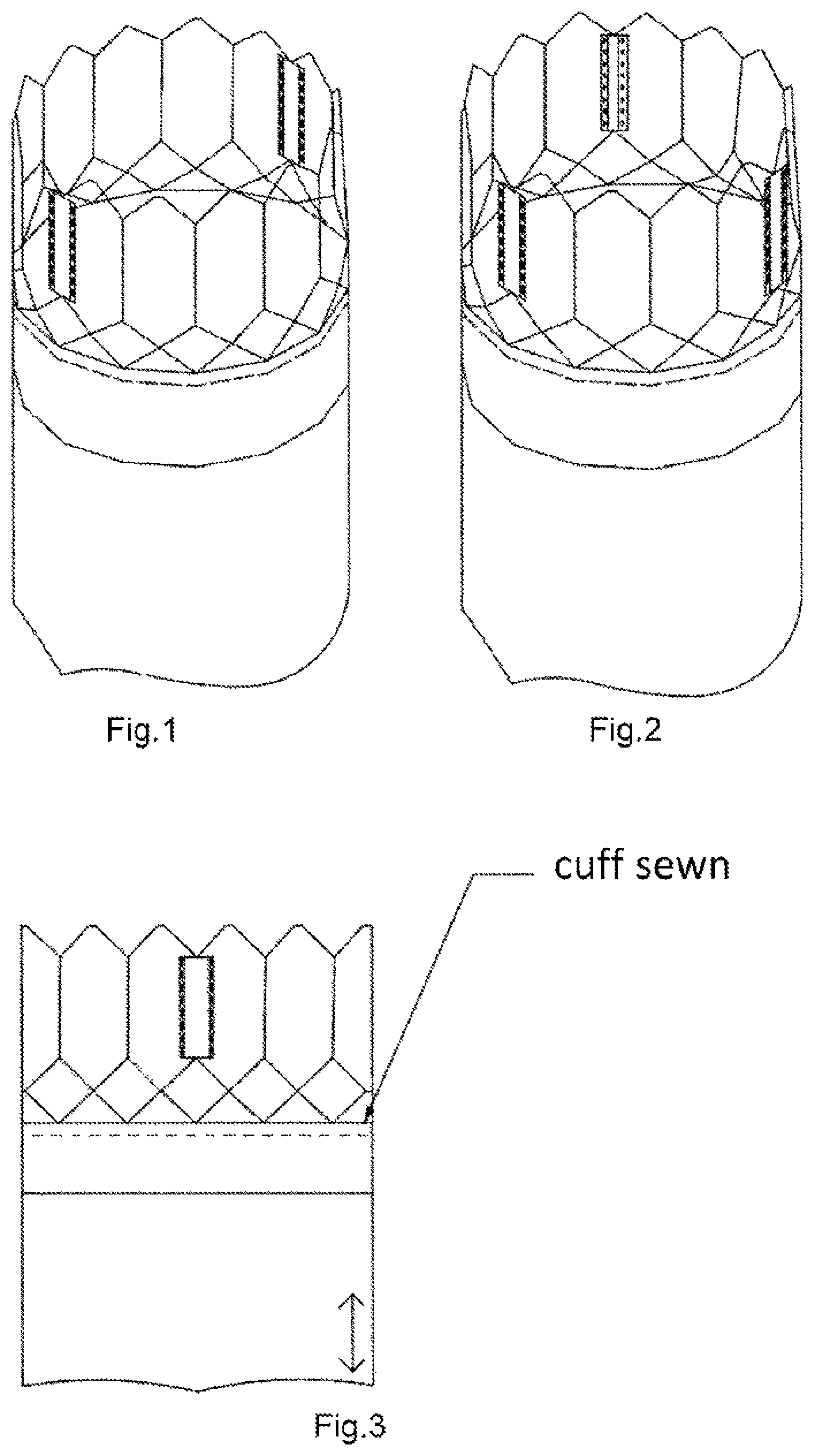 Patent US12102527 — Biological low profile, balloon expandable prosthetic heart valve, particularly aortic, for transcatheter implantation and the method of its manufacturing — Figure 1