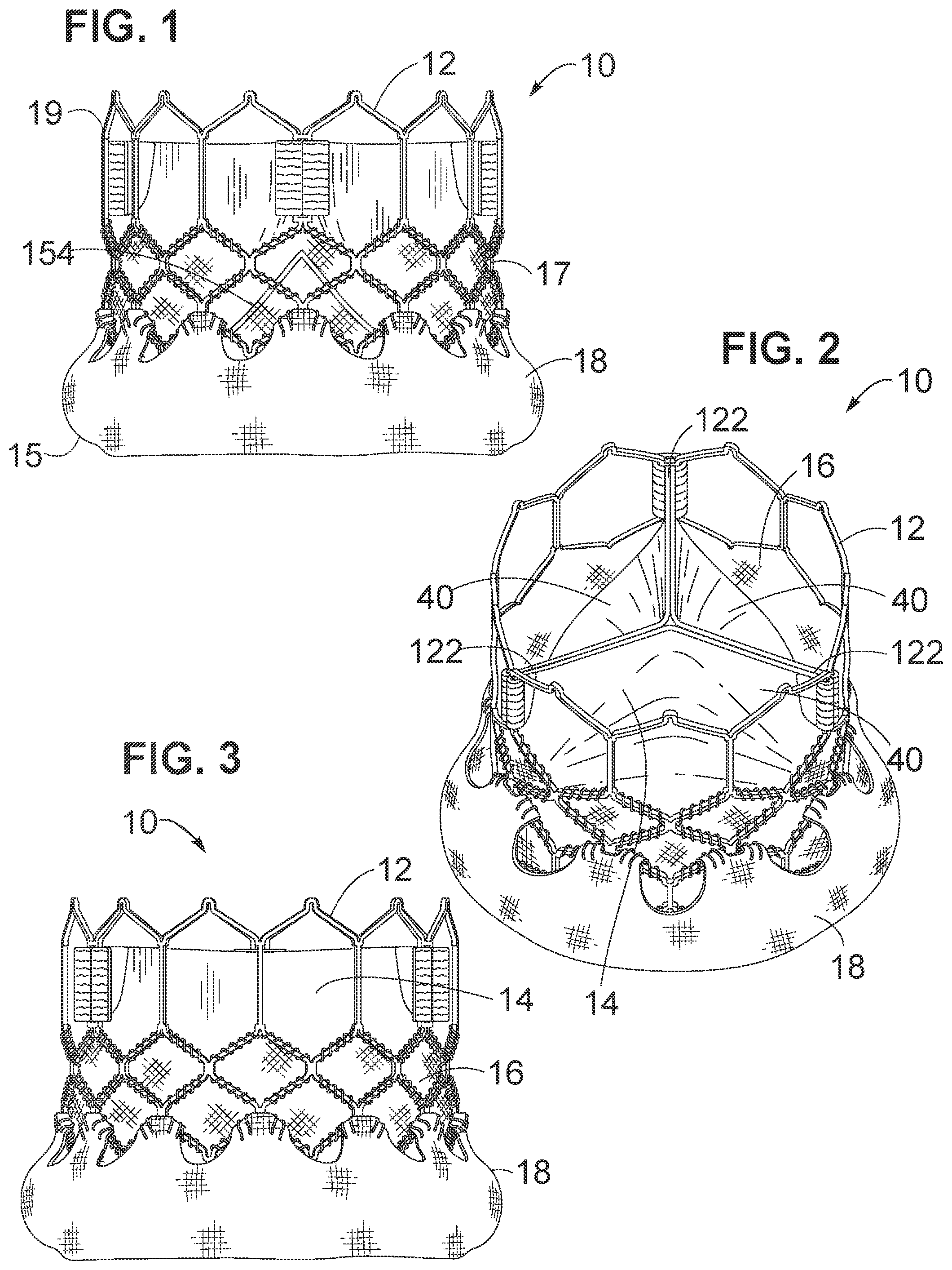 Patent US12102528 — Prosthetic heart valve — Figure 1