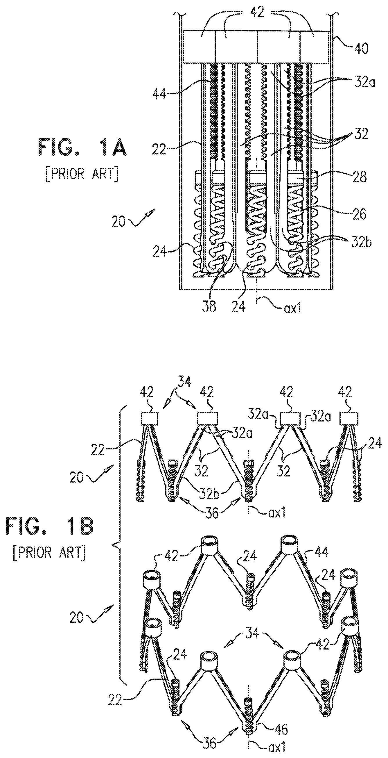 Patent US12102533 Figure 1 – Adjustable annuloplasty device with alternating peaks and troughs