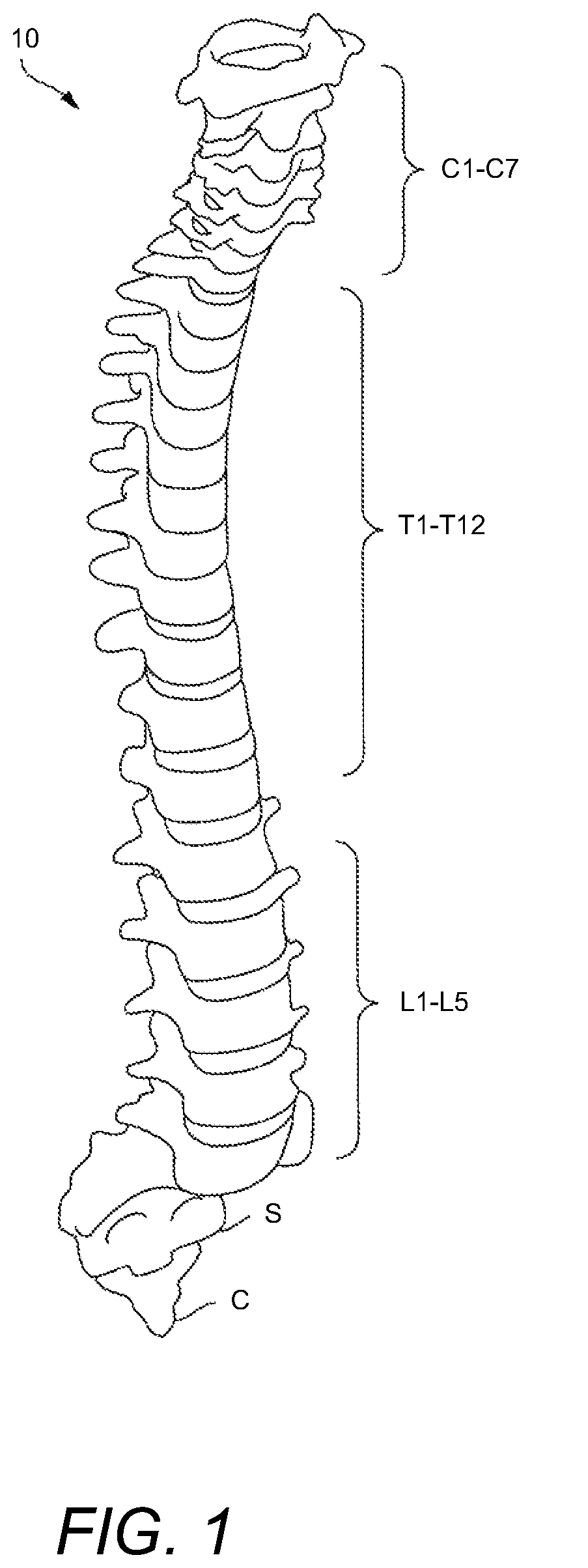 Patent US12102537 — Minimally invasive expandable intervertebral fusion implant — Figure 1