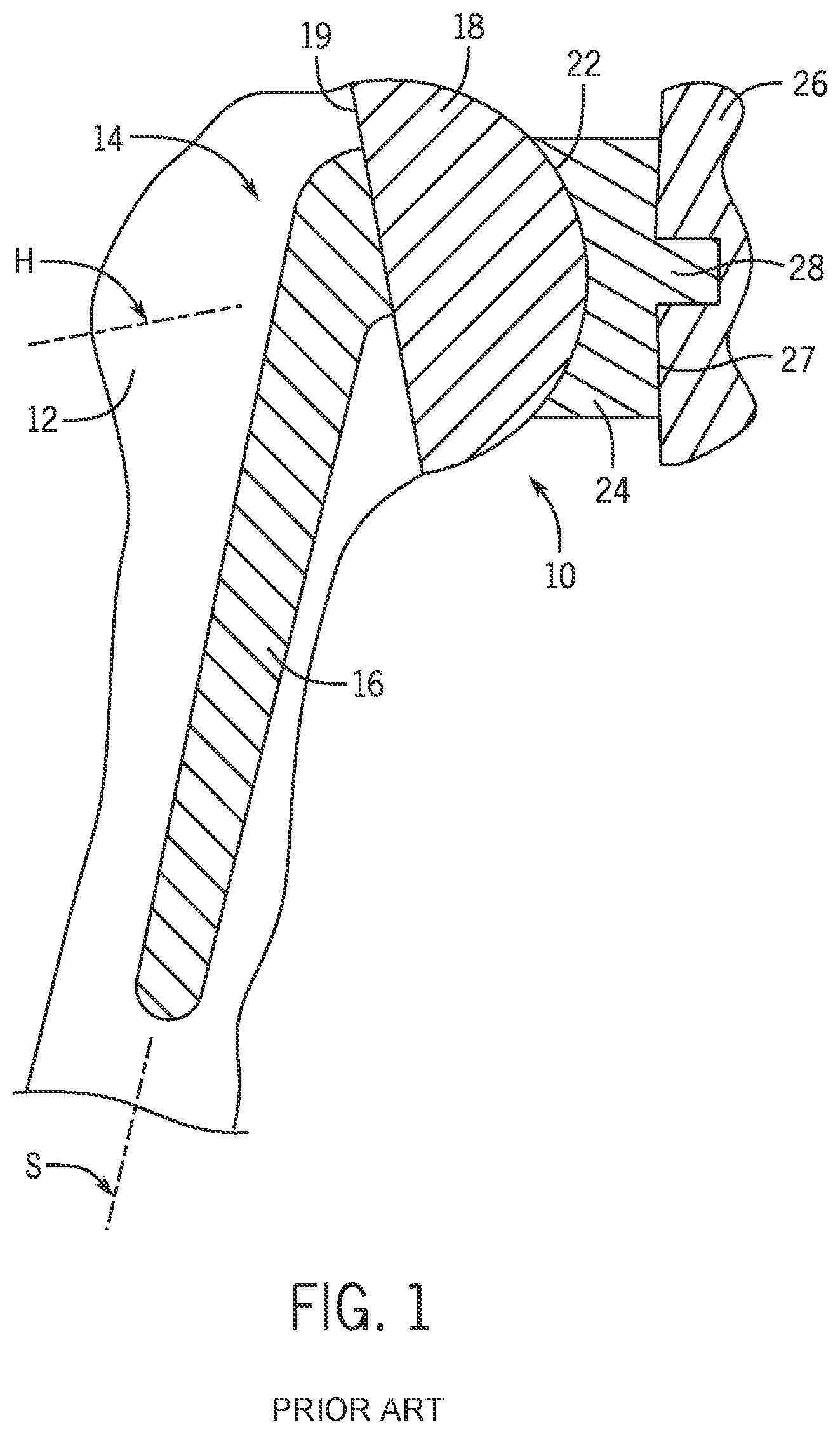 Patent US12102541 — Shoulder prosthesis with variable inclination humeral head component — Figure 1