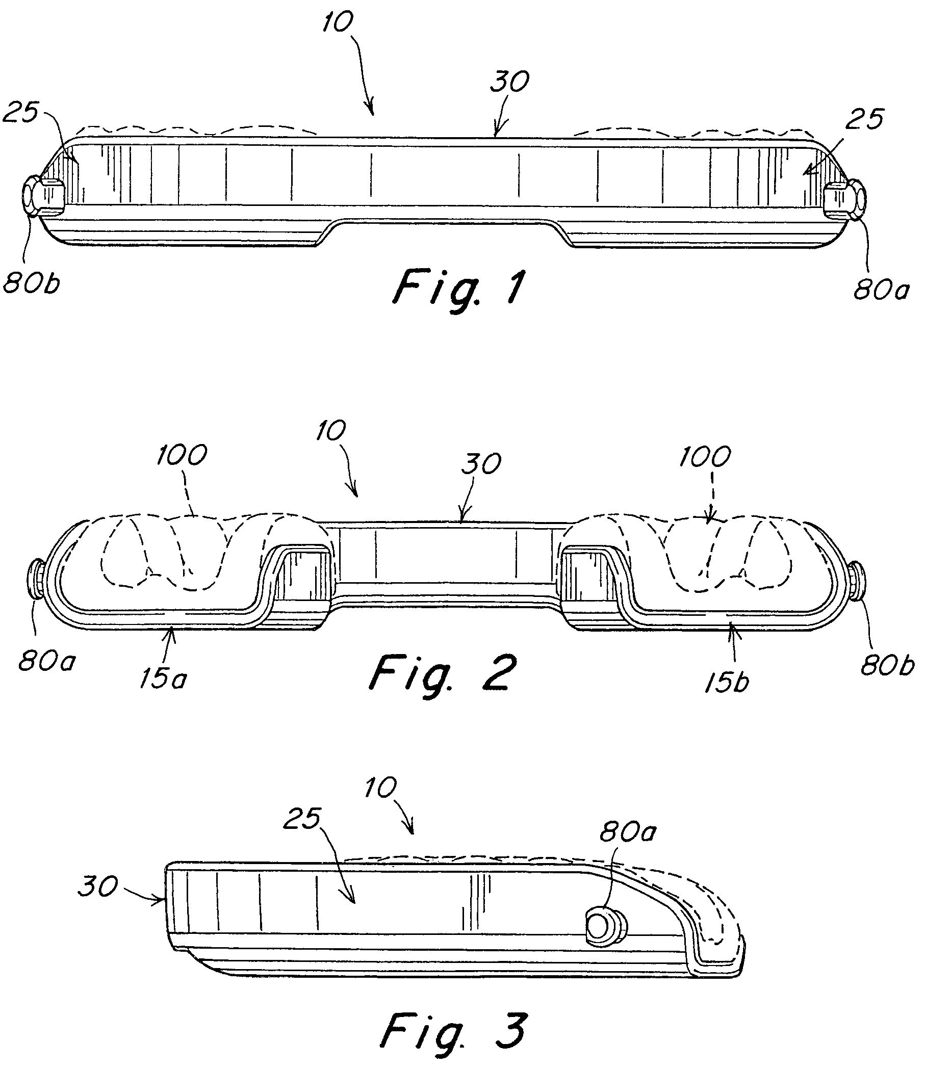 Patent US12102555 — Oral appliance — Figure 1