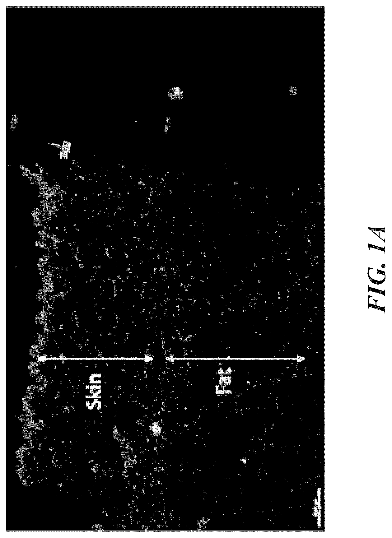 Patent US12102557 Figure 1 – Methods, devices, and systems for improving skin characteristics