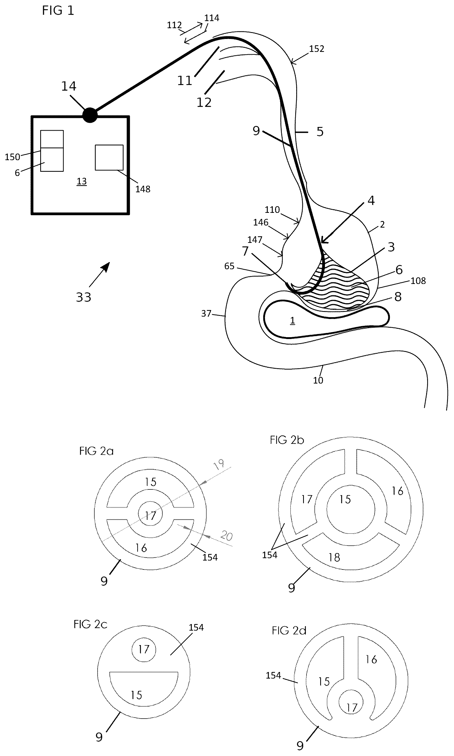 Patent US12102558 Figure 1 – Apparatus and method for cooling and/or heating an organ