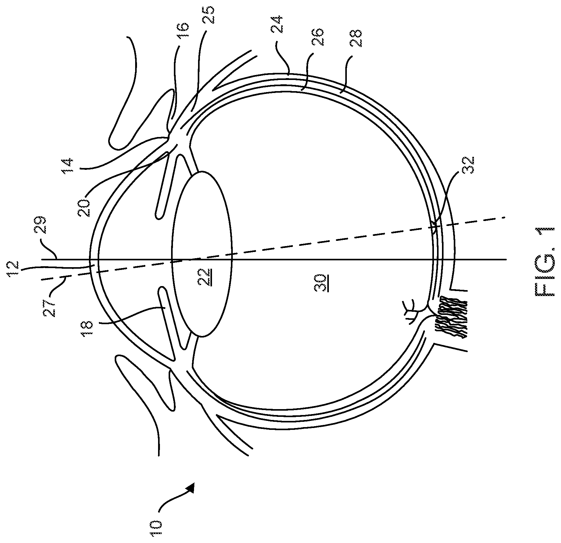 Patent US12102560 — Implantable ocular drug delivery devices — Figure 1