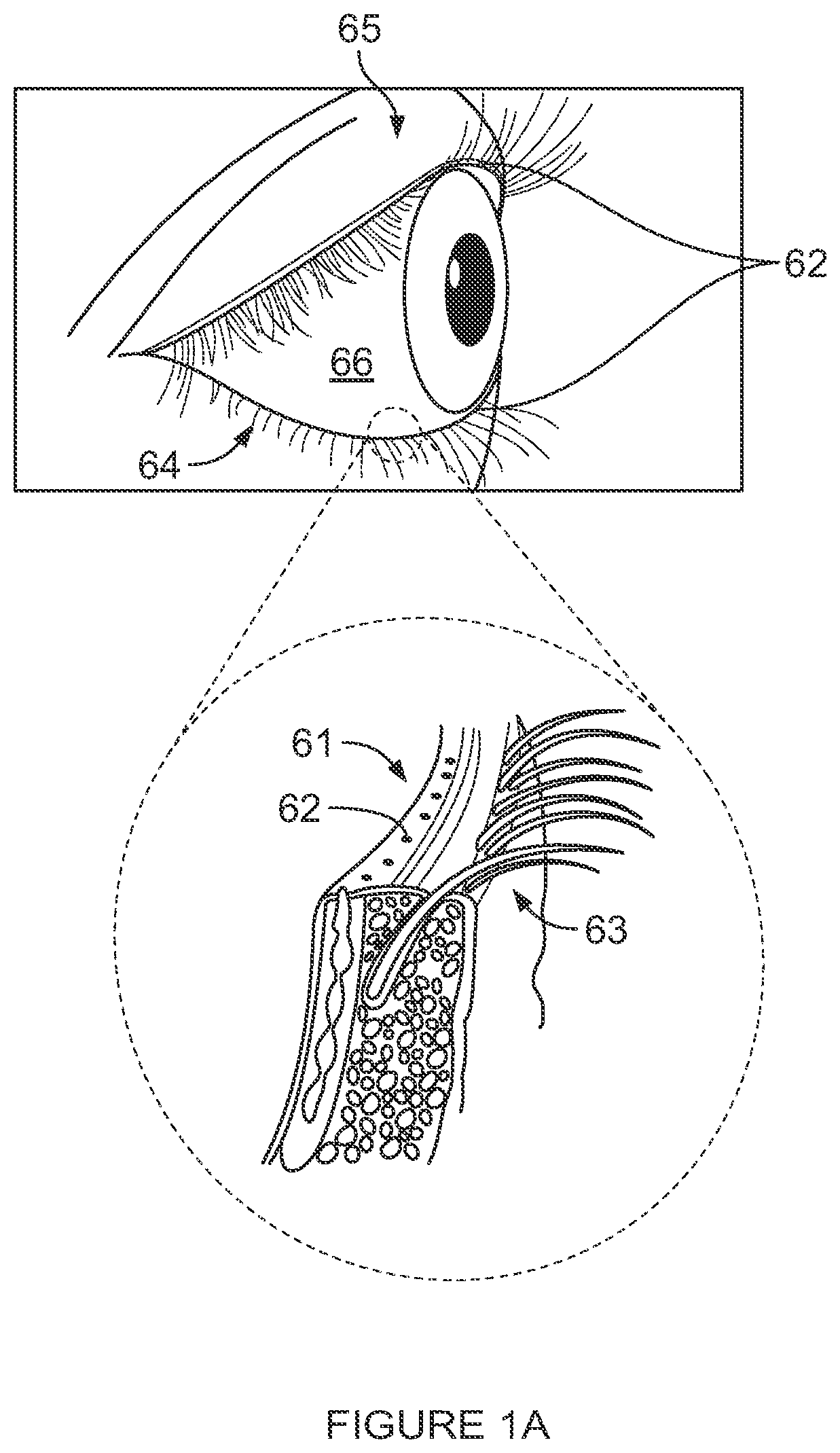 Patent US12102561 — Multi-modal thermal therapy for Blepharitis, Meibomian Gland Dysfunction and Dry Eye Syndrome — Figure 1