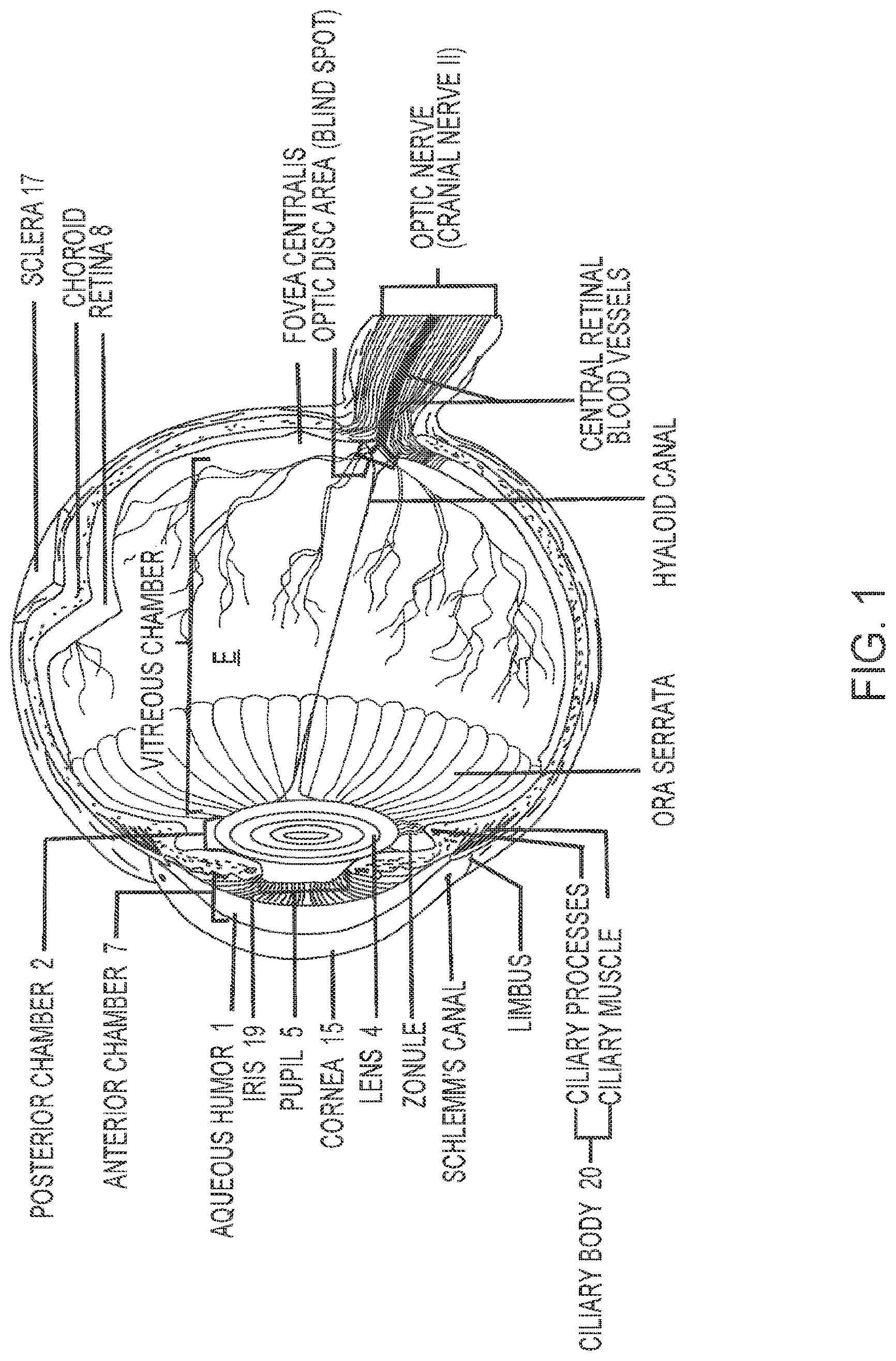 Patent US12102562 — Methods and systems for OCT guided glaucoma surgery — Figure 1