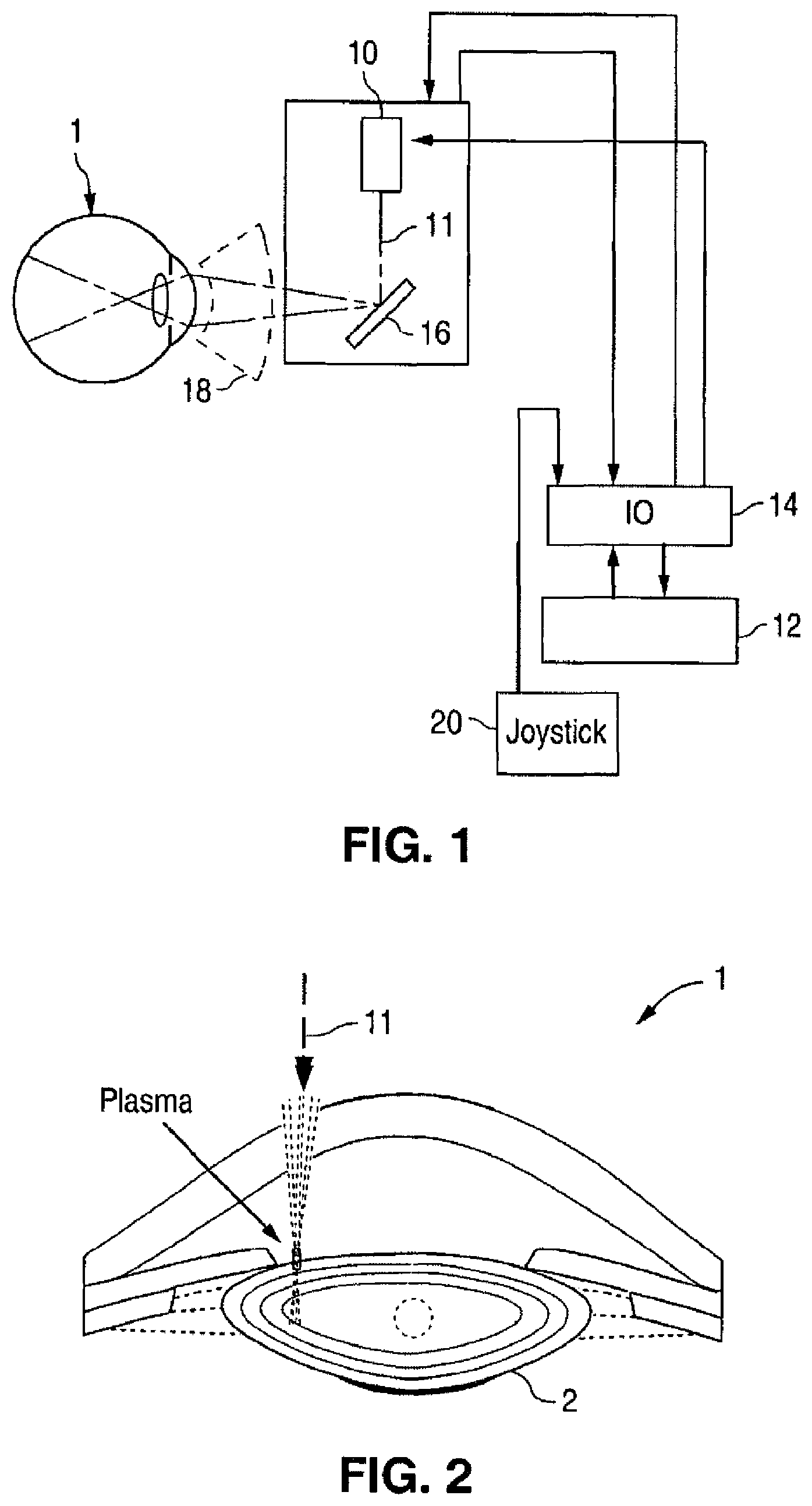 Patent US12102565 Figure 1 – Apparatus for patterned plasma-mediated laser ophthalmic surgery