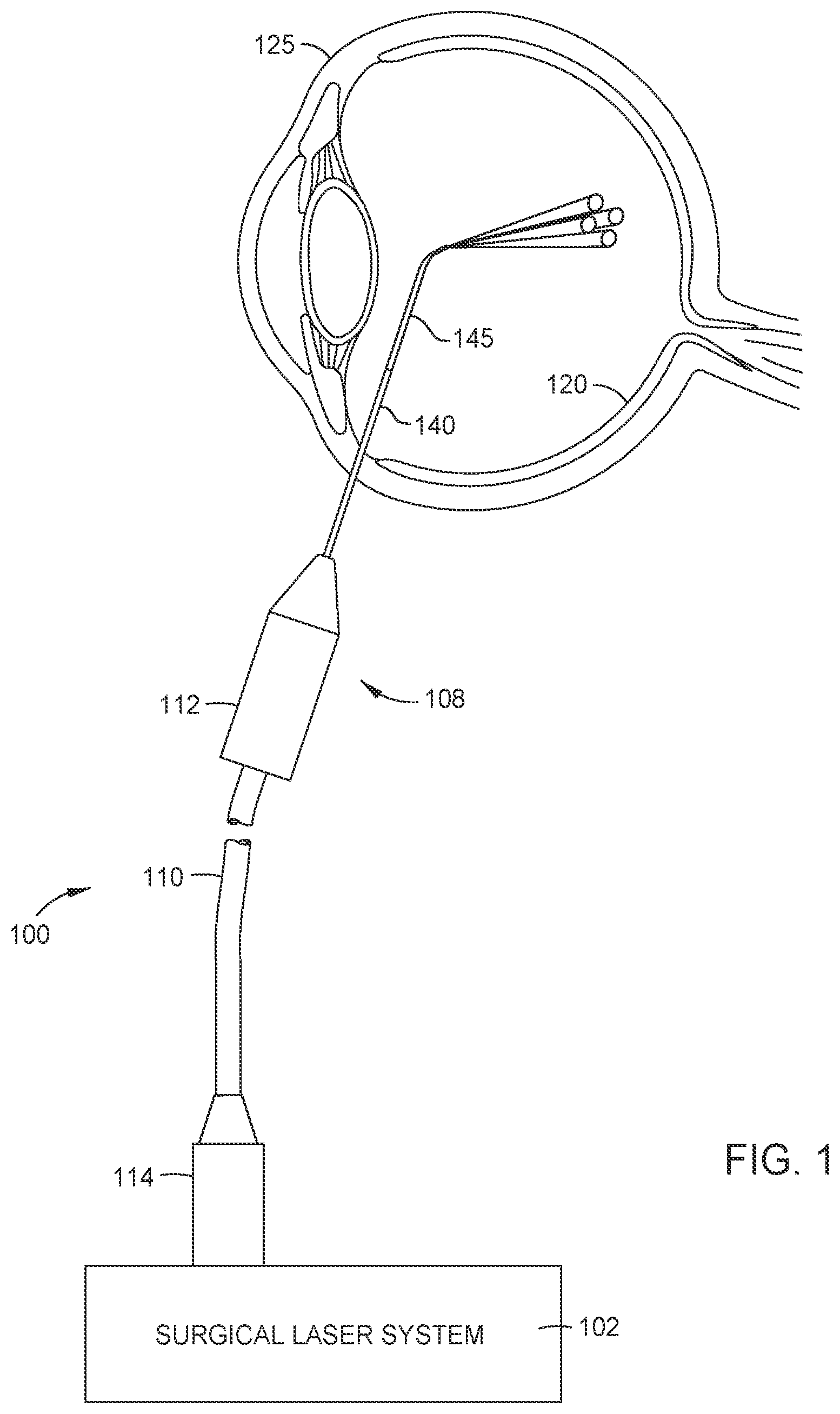 Patent US12102567 — Beam detection with dual gain — Figure 1