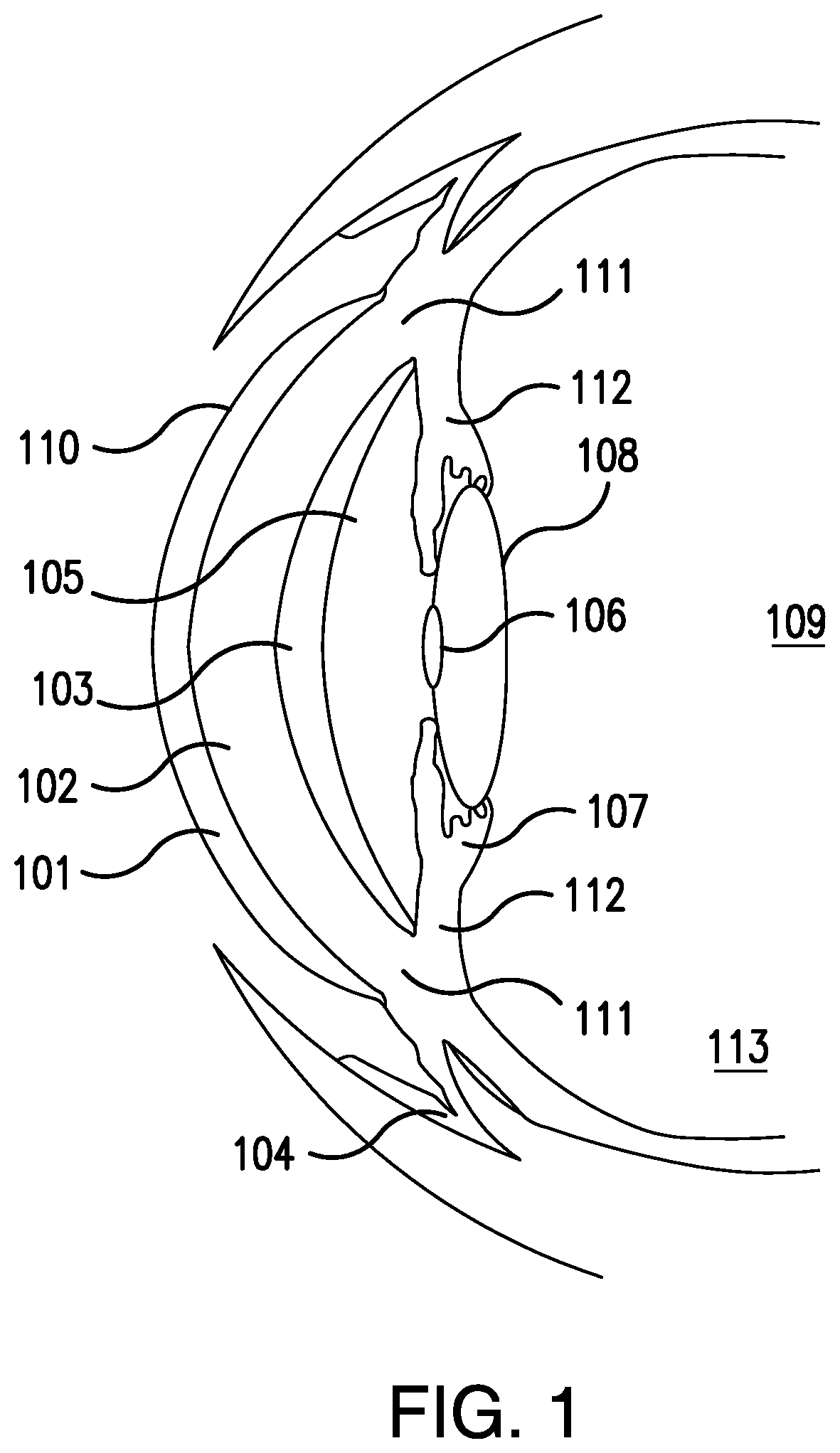 Patent US12102622 — Methods for ophthalmic delivery of roflumilast — Figure 1