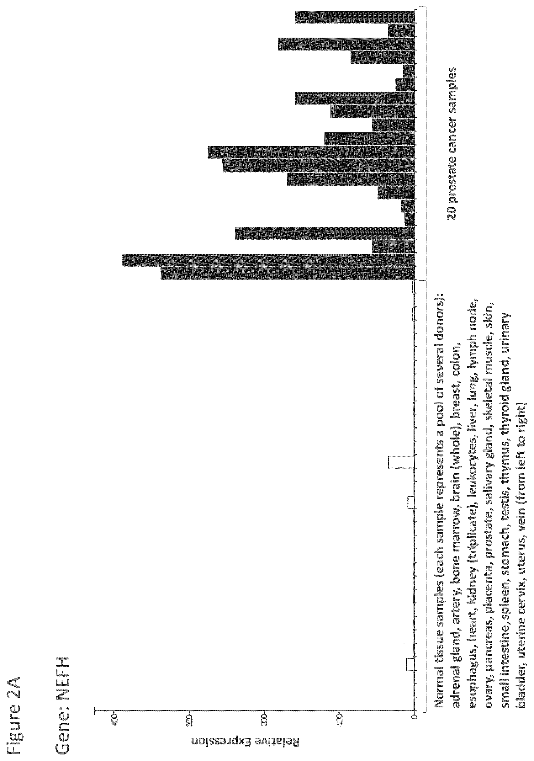 Patent US12102670 Figure 20 – Peptides and combination of peptides for use in immunotherapy against prostate cancer and other cancers