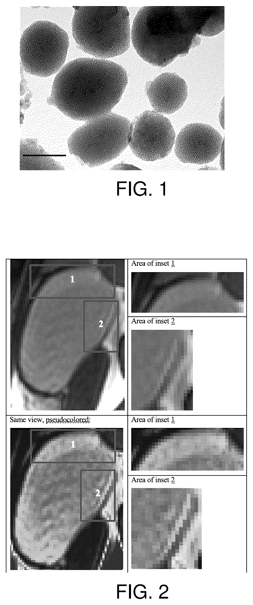 Patent US12102693 — Pharmaceutical composition with nanoparticle-based drug delivery combined with non-invasive radiographic monitoring model — Figure 1