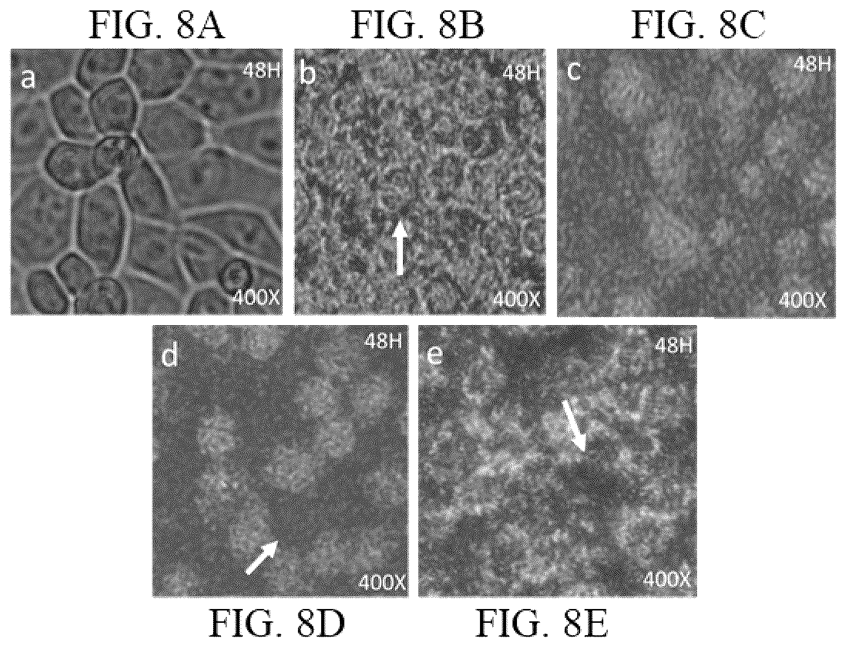 Patent US12102717 Figure 6 – Hollow silica spheres with nested iron oxide particles