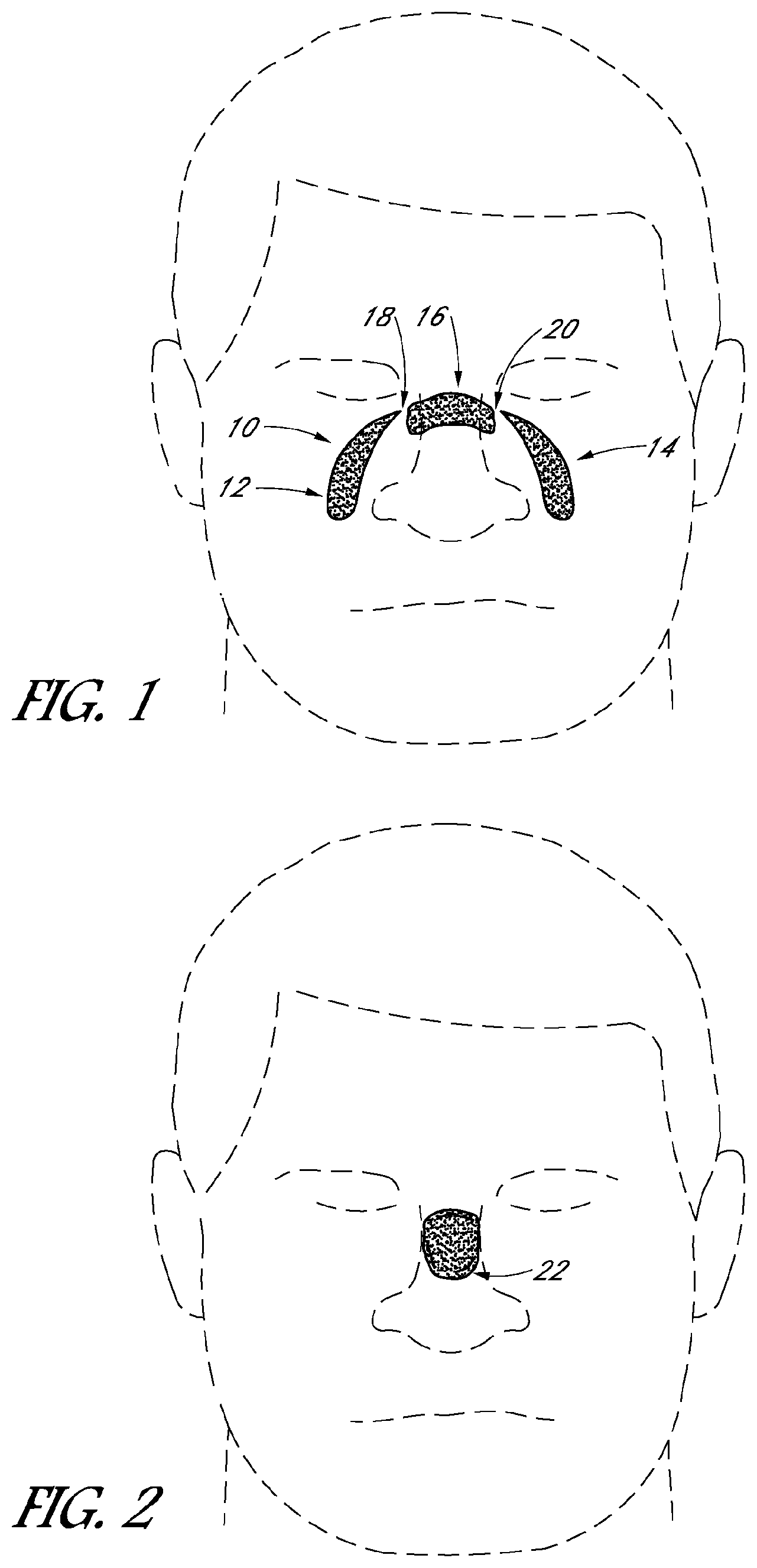 Patent US12102759 — Sealing force detection enabled, therapeutic fluid delivery device — Figure 1