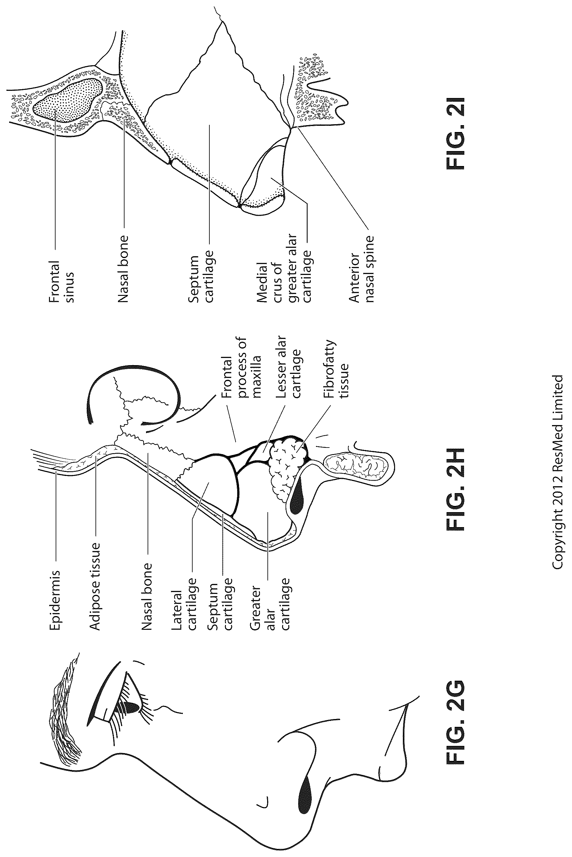Patent US12102760 Figure 10 – Patient interface