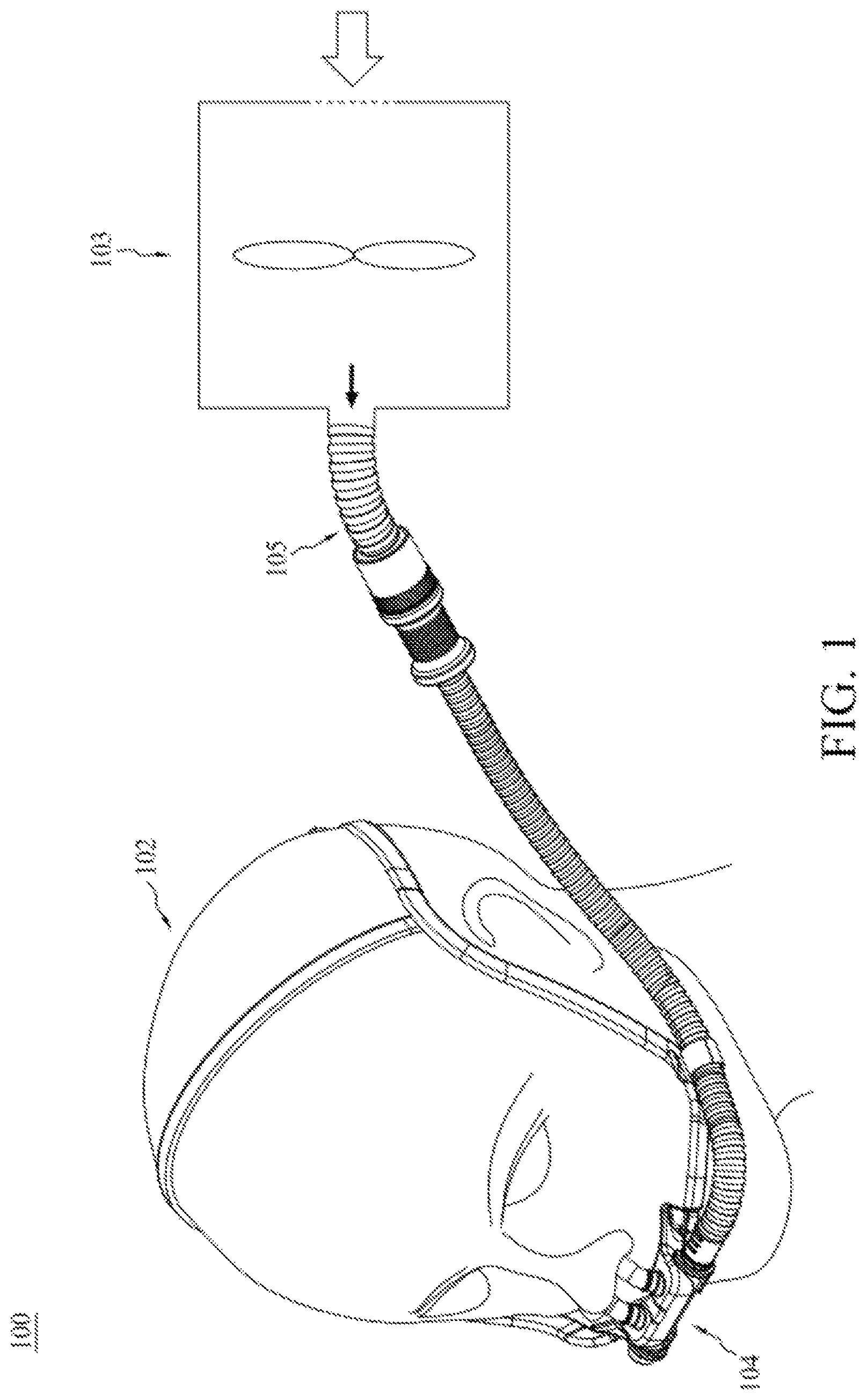 Patent US12102762 — Nasal cannula device — Figure 1