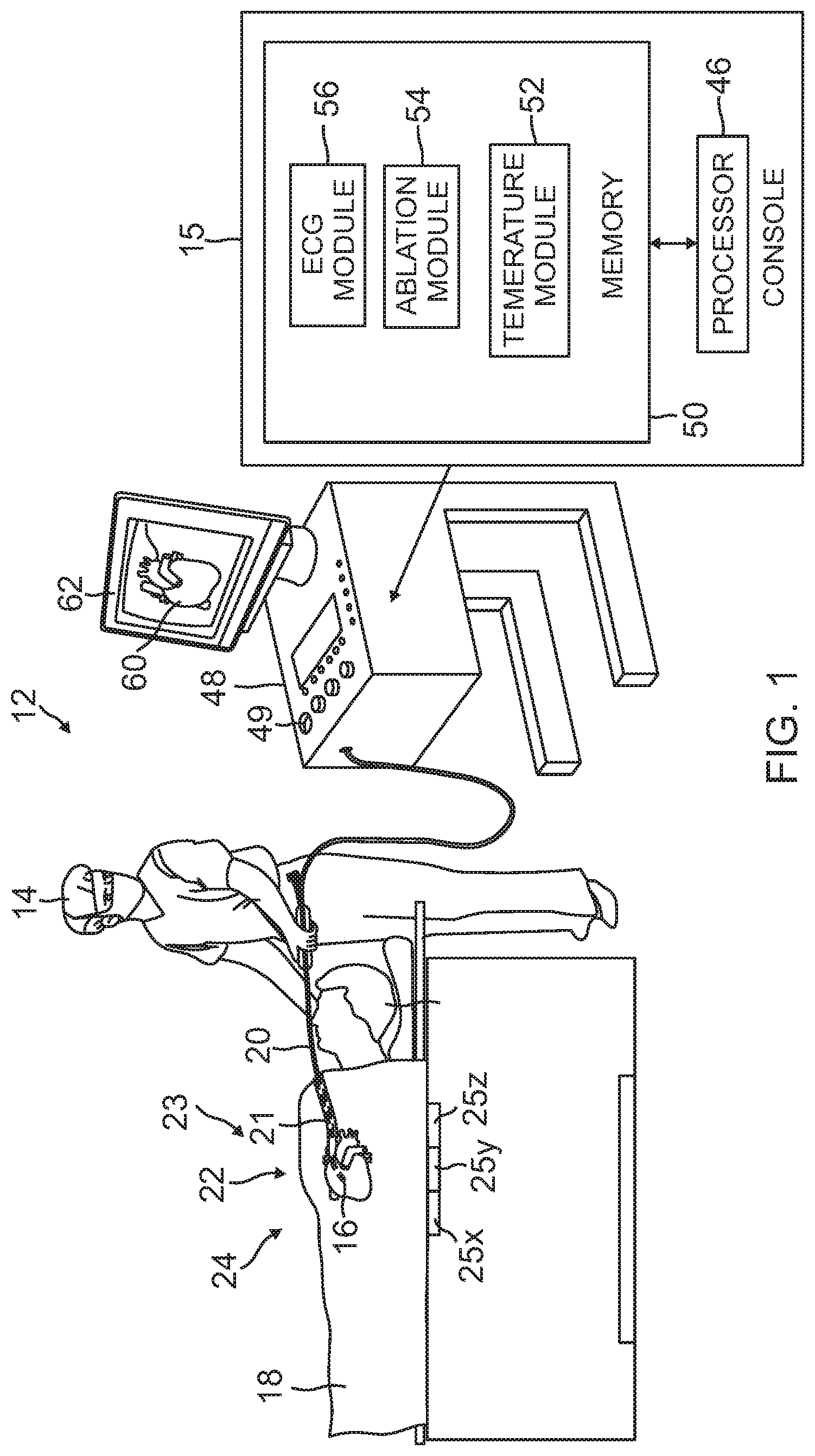 Patent US12102781 — Reinforcement for irrigated electrophysiology balloon catheter with flexible-circuit electrodes — Figure 1