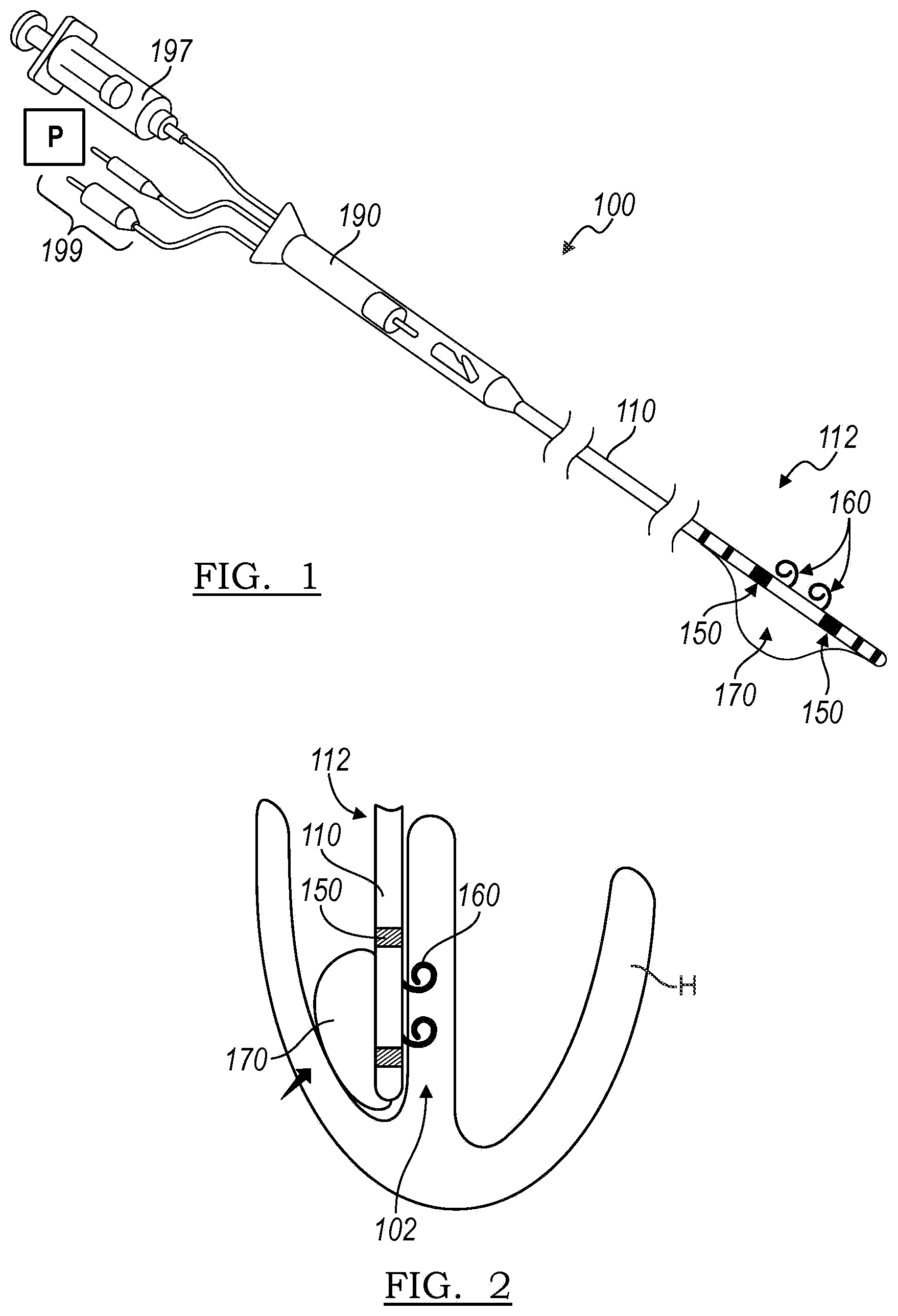 Patent US12102821 Figure 1 – Device and method for positioning an electrode in tissue