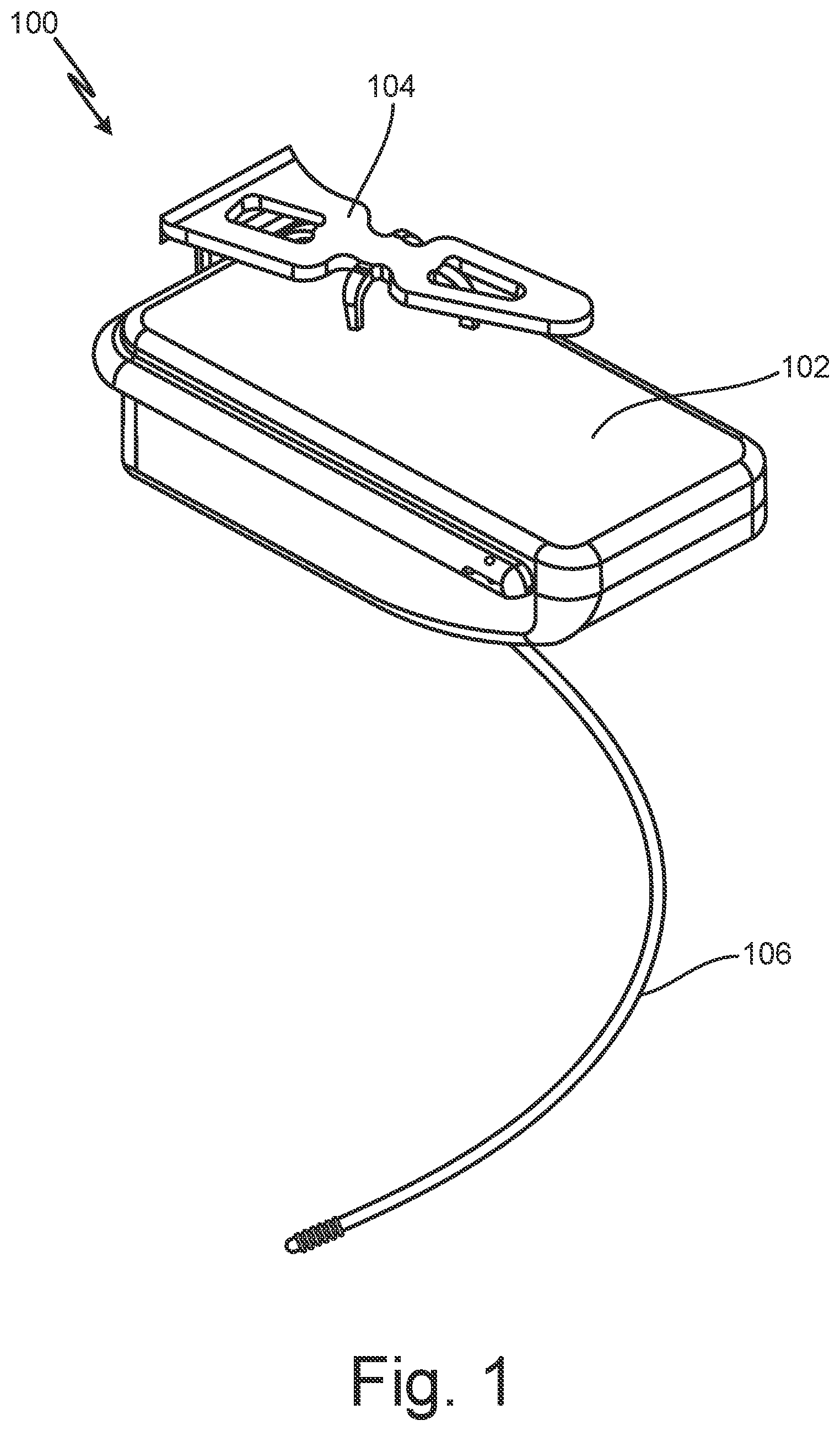 Patent US12102824 — Subcutaneous device for preventing and treating atherosclerosis — Figure 1