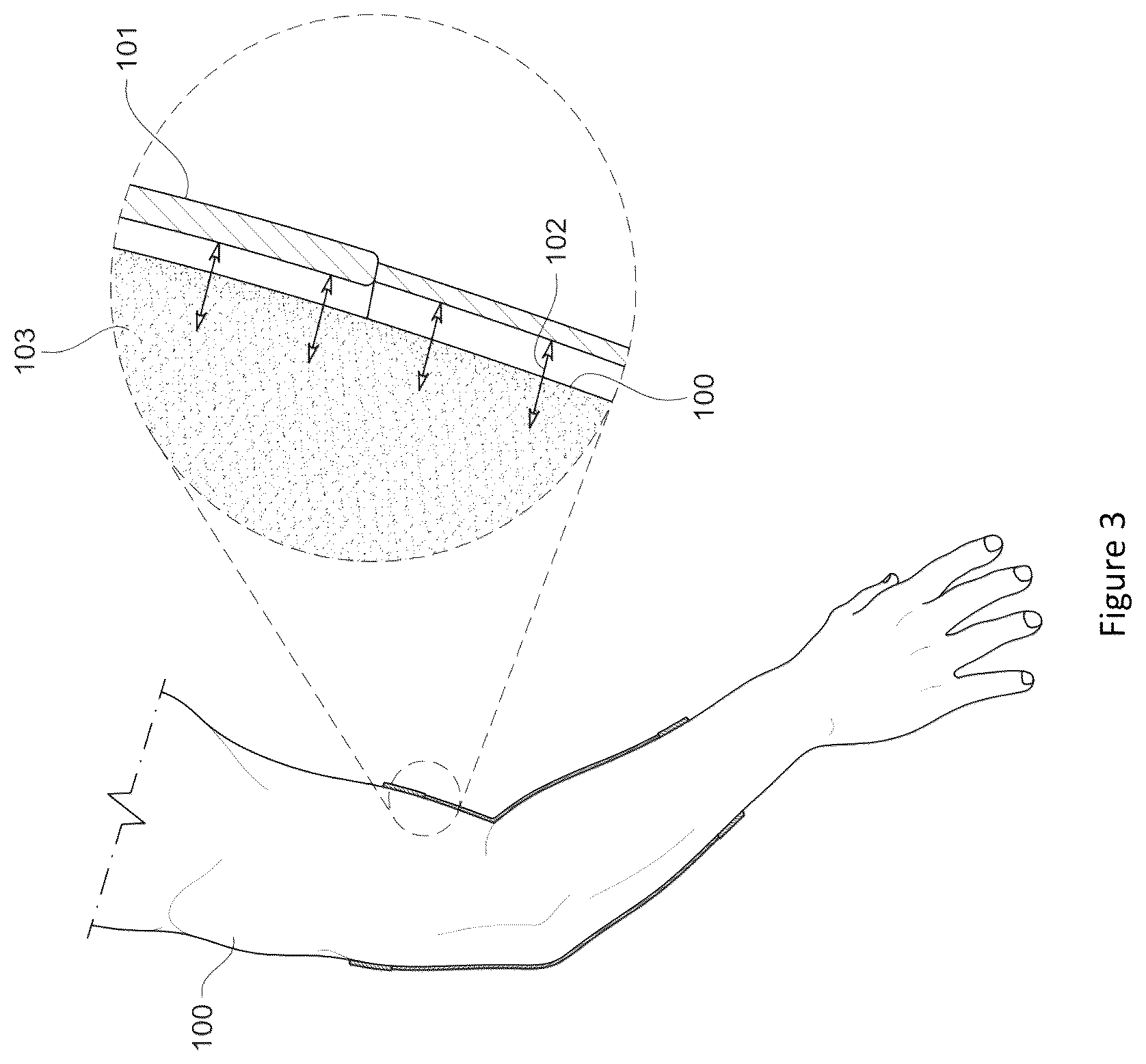 Patent US12102825 Figure 3 – Material and apparel that positively affect the health and wellbeing of a mammal