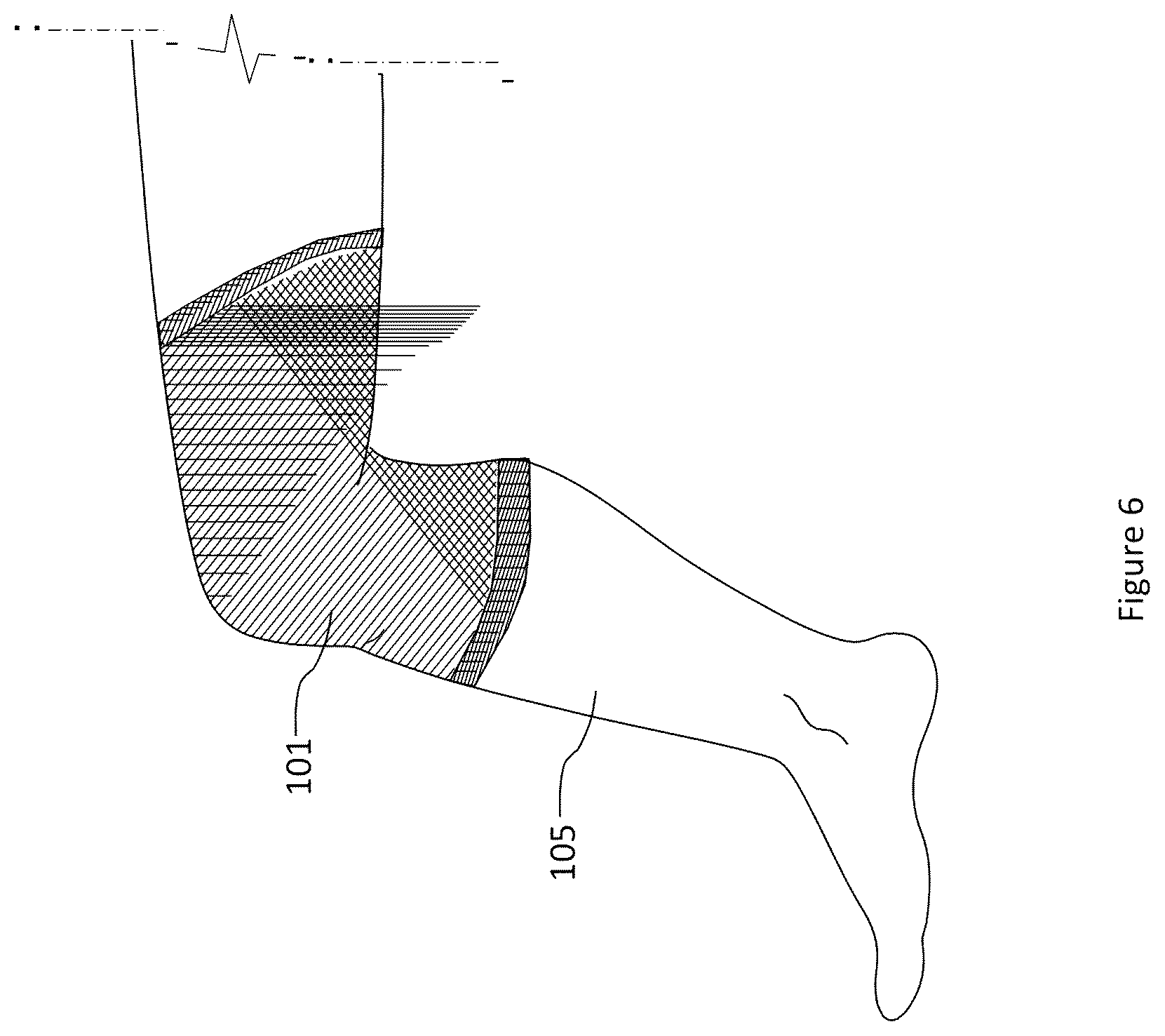 Patent US12102825 Figure 6 – Material and apparel that positively affect the health and wellbeing of a mammal