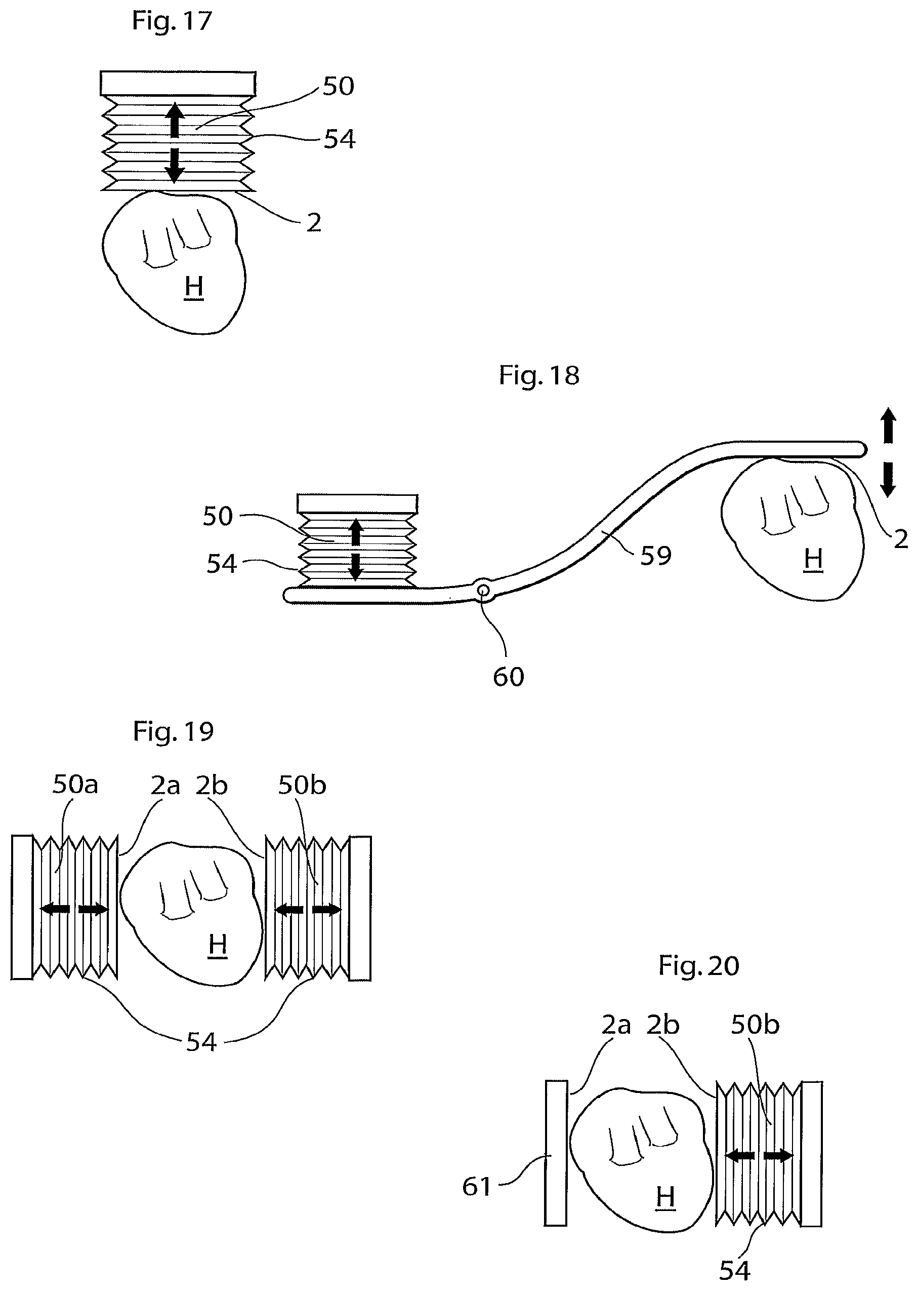 Patent US12102829 Figure 8 – Heart help device, method and system