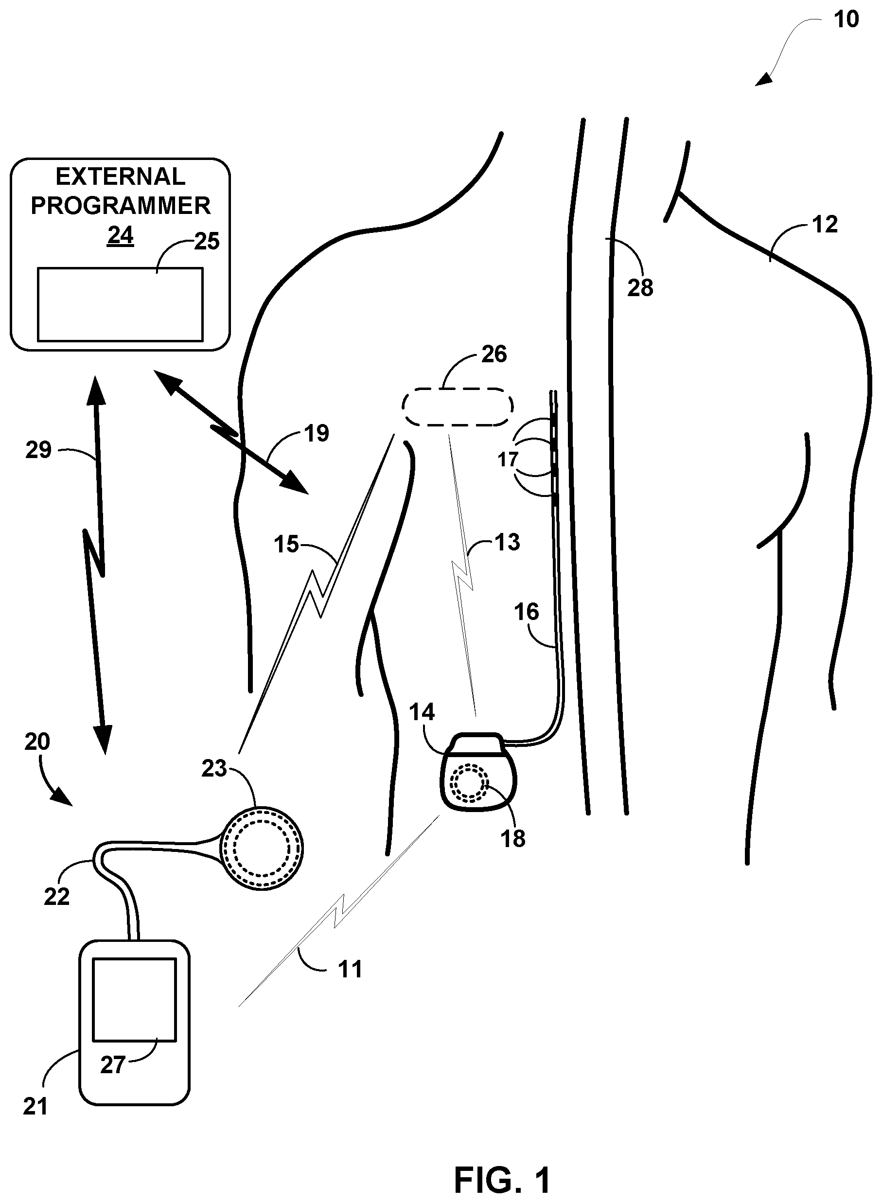 Patent US12102833 Figure 1 – Medical device recharging based on patient activity