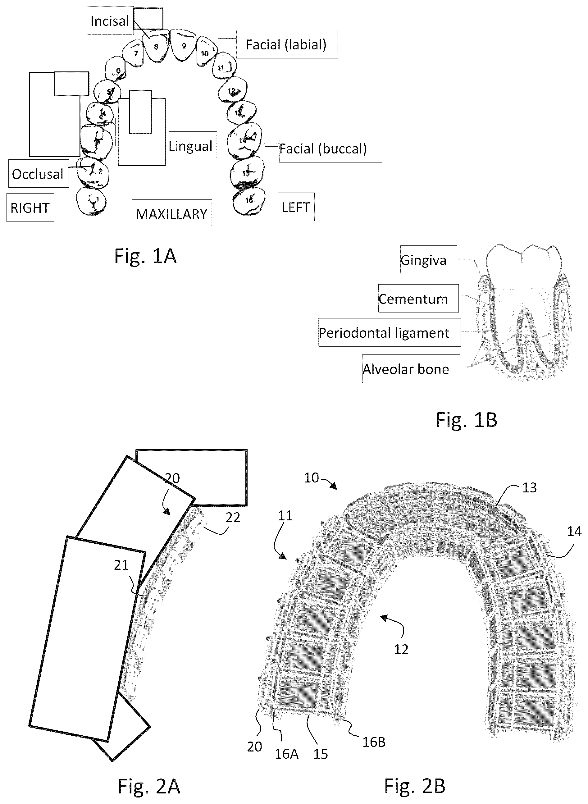 Patent US12102841 — Mouthpiece and method for intraoral treatment — Figure 1