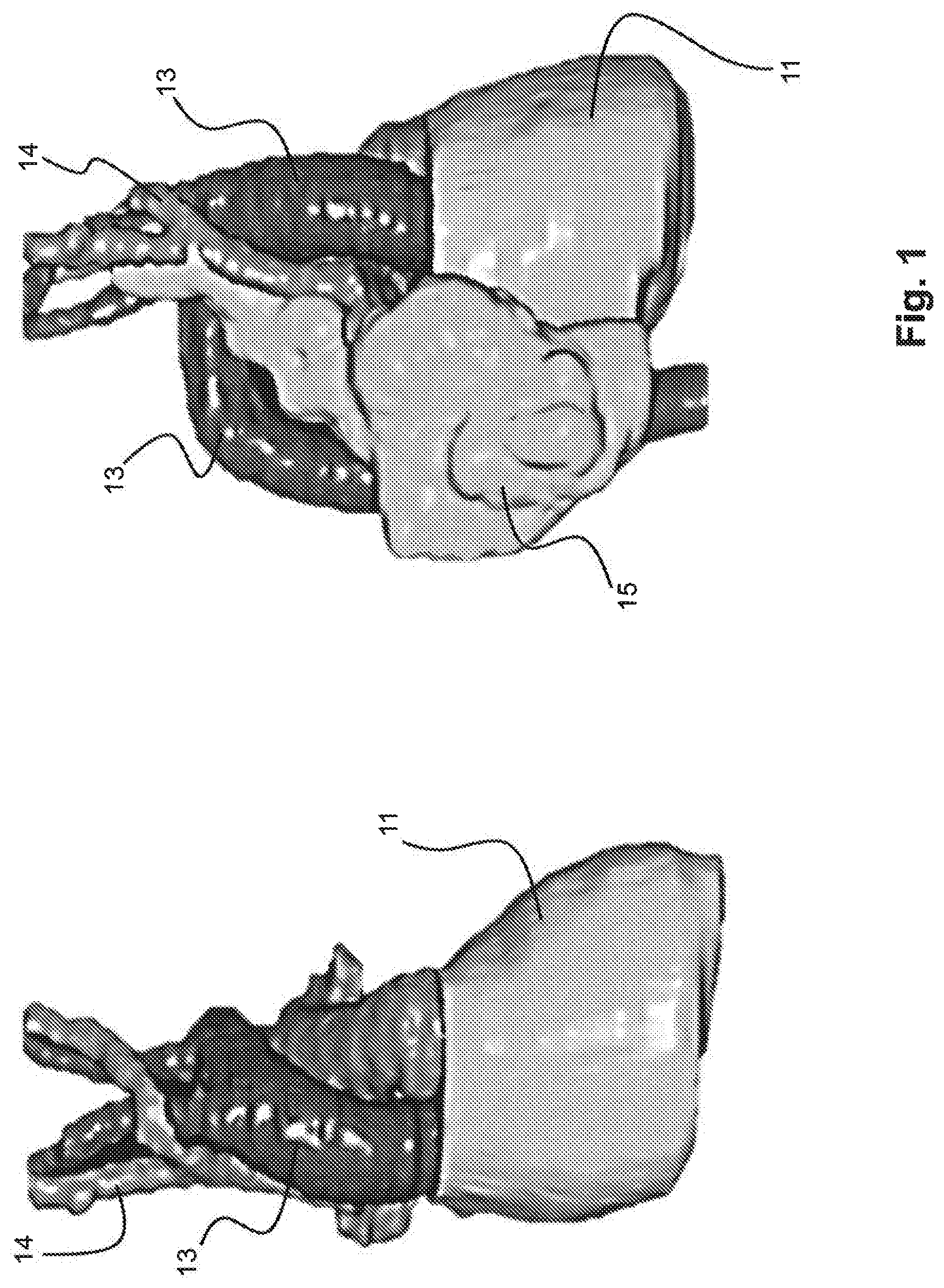 Patent US12102842 — Treatment and planning for lymphocytes sparing radiotherapy — Figure 1