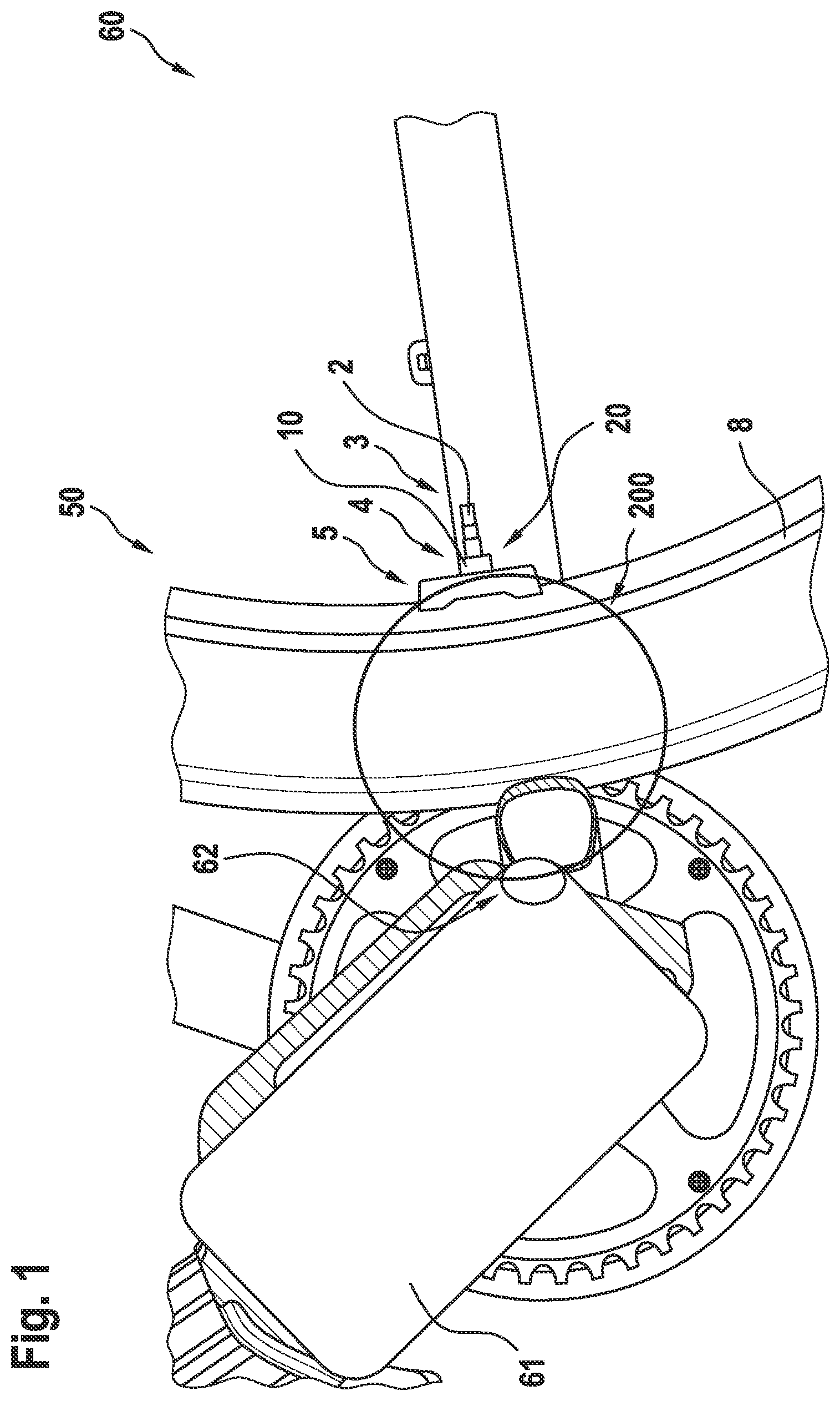 Patent US12103626 — Rim magnet arrangement for fixing a magnet on a rim by way of a stem of a valve — Figure 1