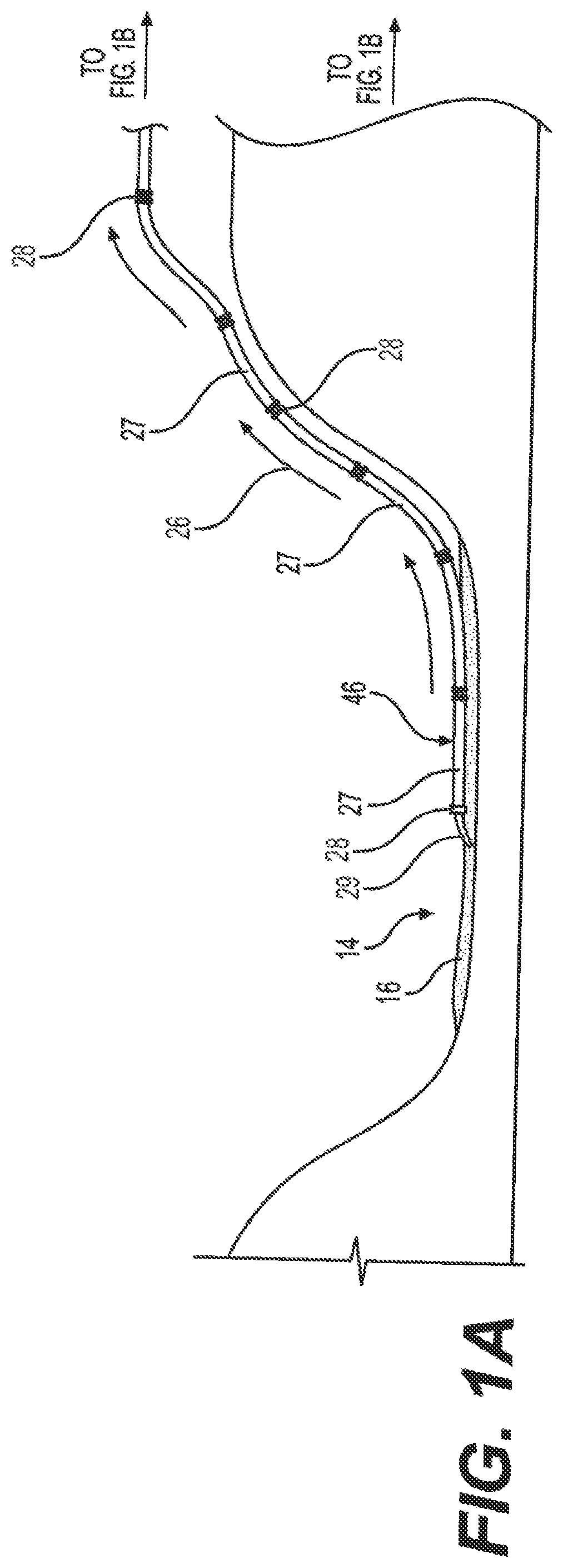 Patent US12103791 — Assemblies and methods for material extraction from retention collections — Figure 1
