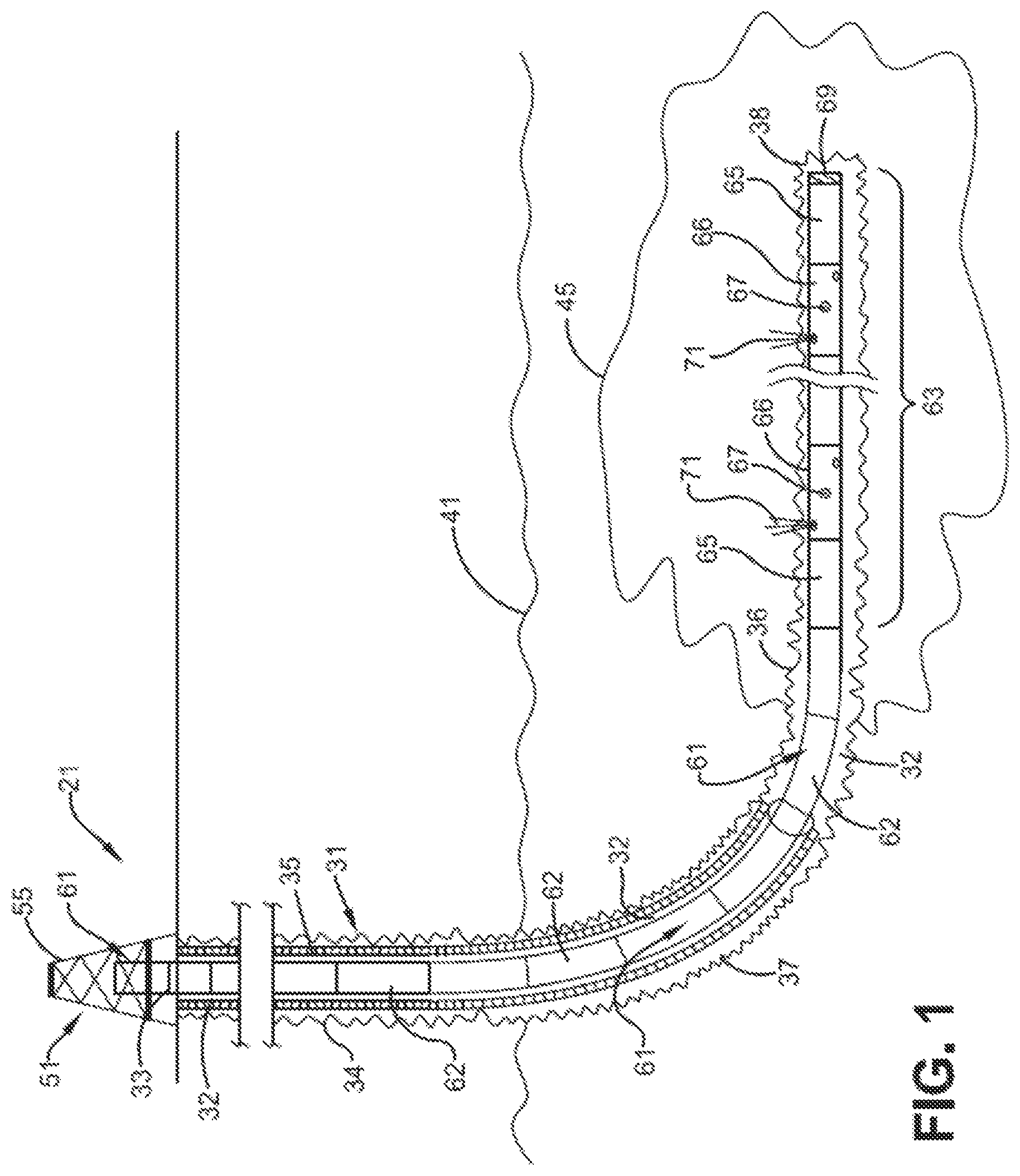 Patent US12104478 — Method and system for stimulating hydrocarbon production — Figure 1