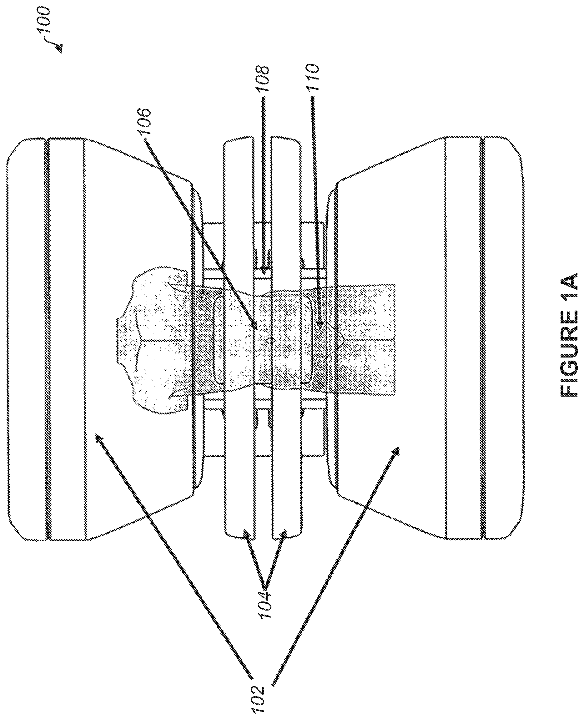 Patent US12105166 — Method and apparatus for shielding a linear accelerator and a magnetic resonance imaging device from each other — Figure 1