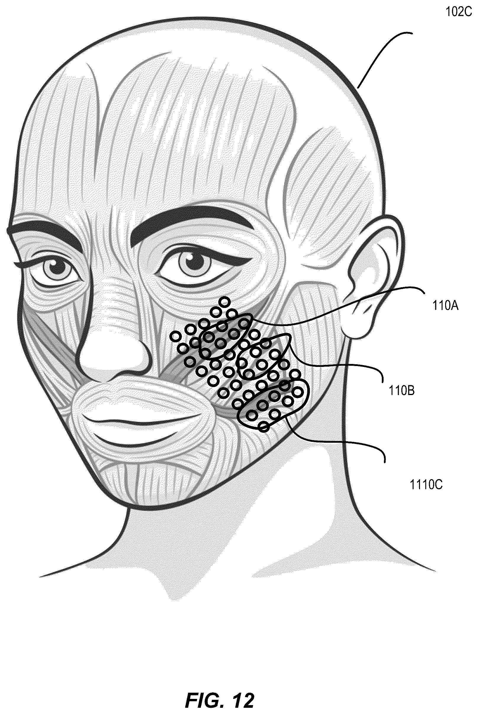 Patent US12105785 Figure 13 – Interpreting words prior to vocalization