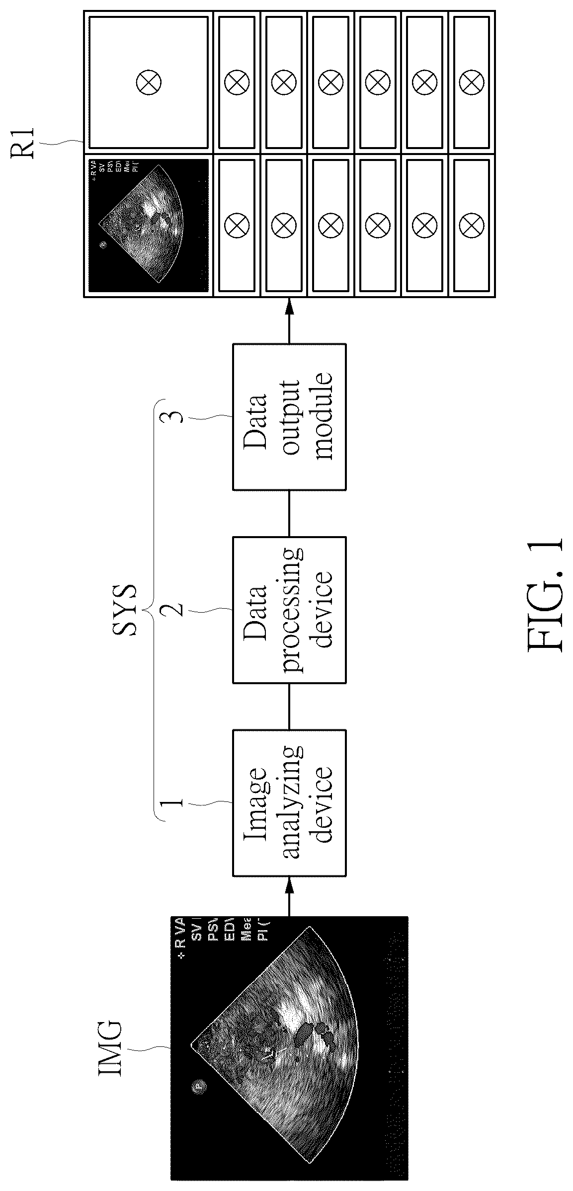 Patent US12106479 — Ultrasound image recognition system and data output module — Figure 1