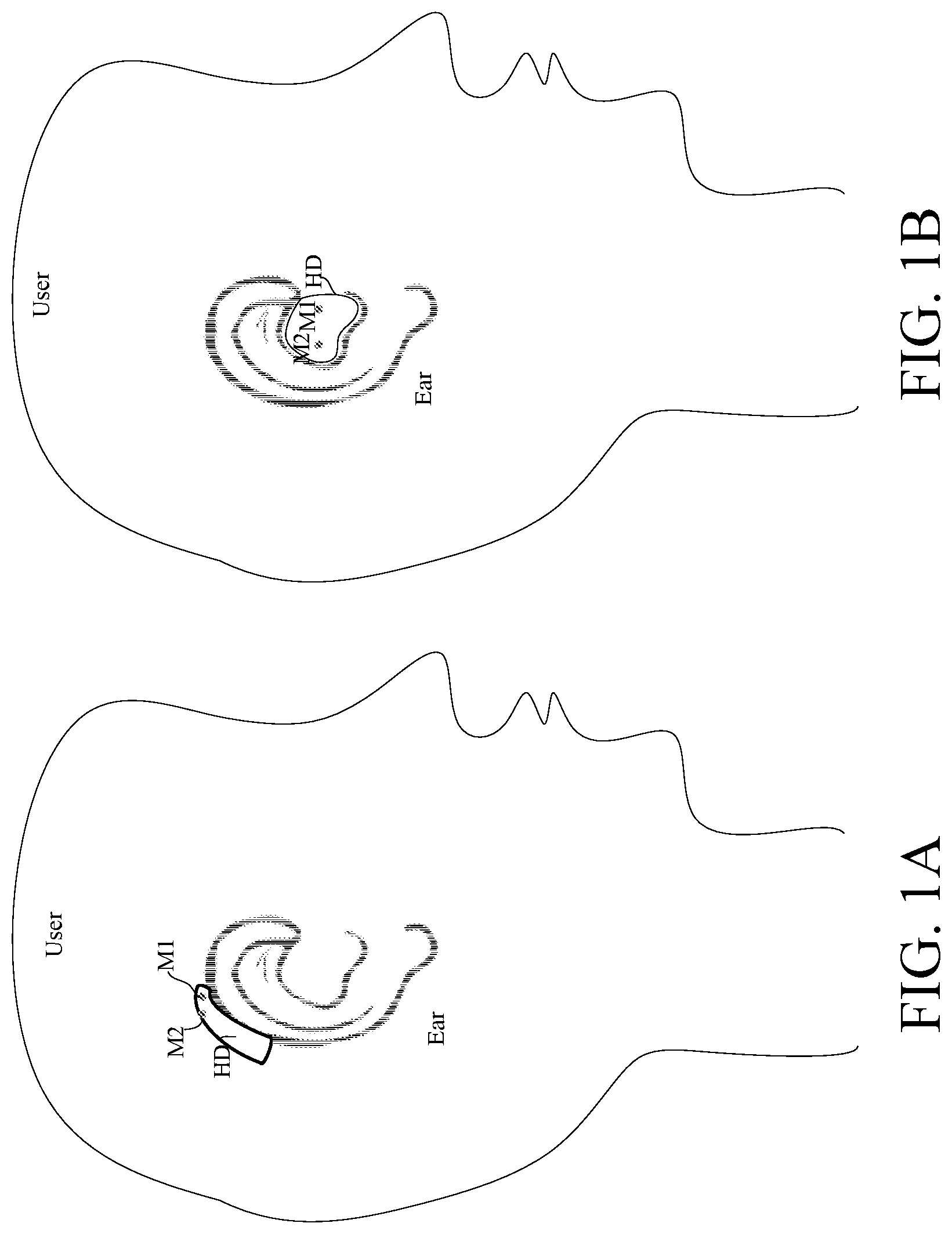 Patent US12108215 — Hearing aid configured to select a reference microphone — Figure 1