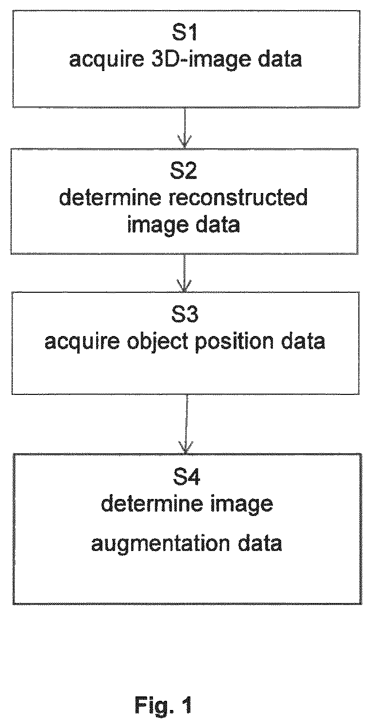 Patent US12112437 — Positioning medical views in augmented reality — Figure 1