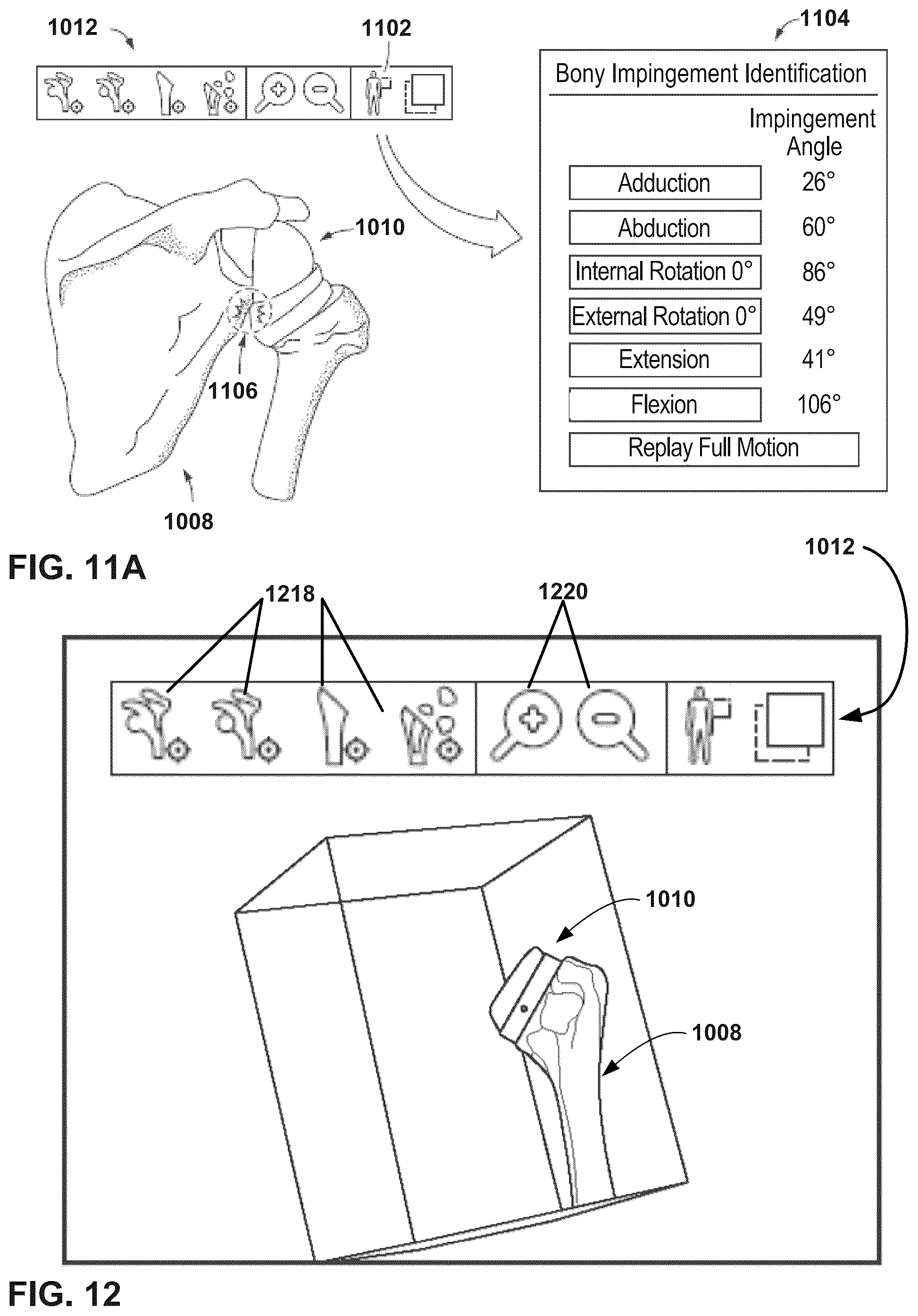 Patent US12112843 Figure 10 – Mixed reality-aided education related to orthopedic surgical procedures