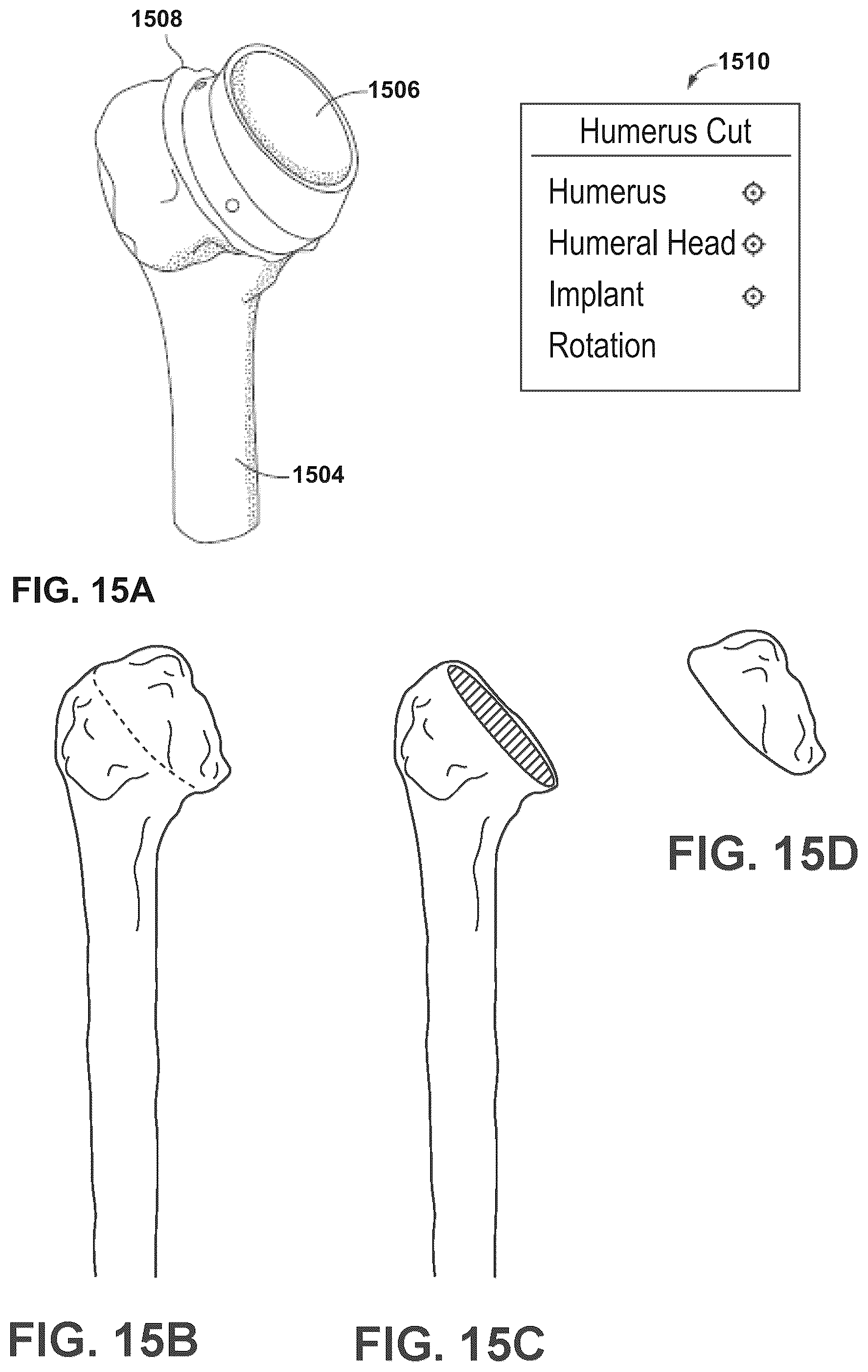 Patent US12112843 Figure 13 – Mixed reality-aided education related to orthopedic surgical procedures