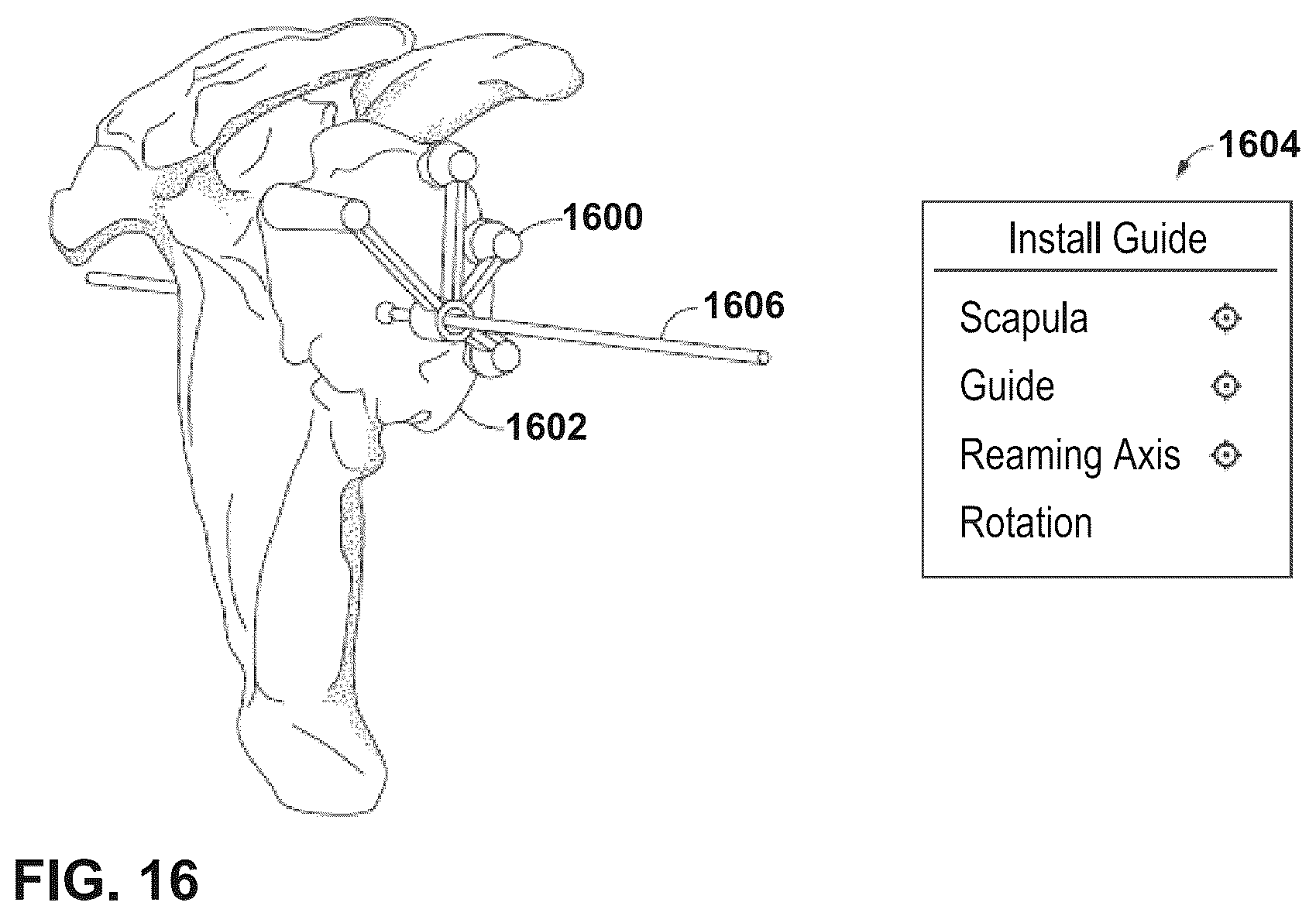 Patent US12112843 Figure 14 – Mixed reality-aided education related to orthopedic surgical procedures