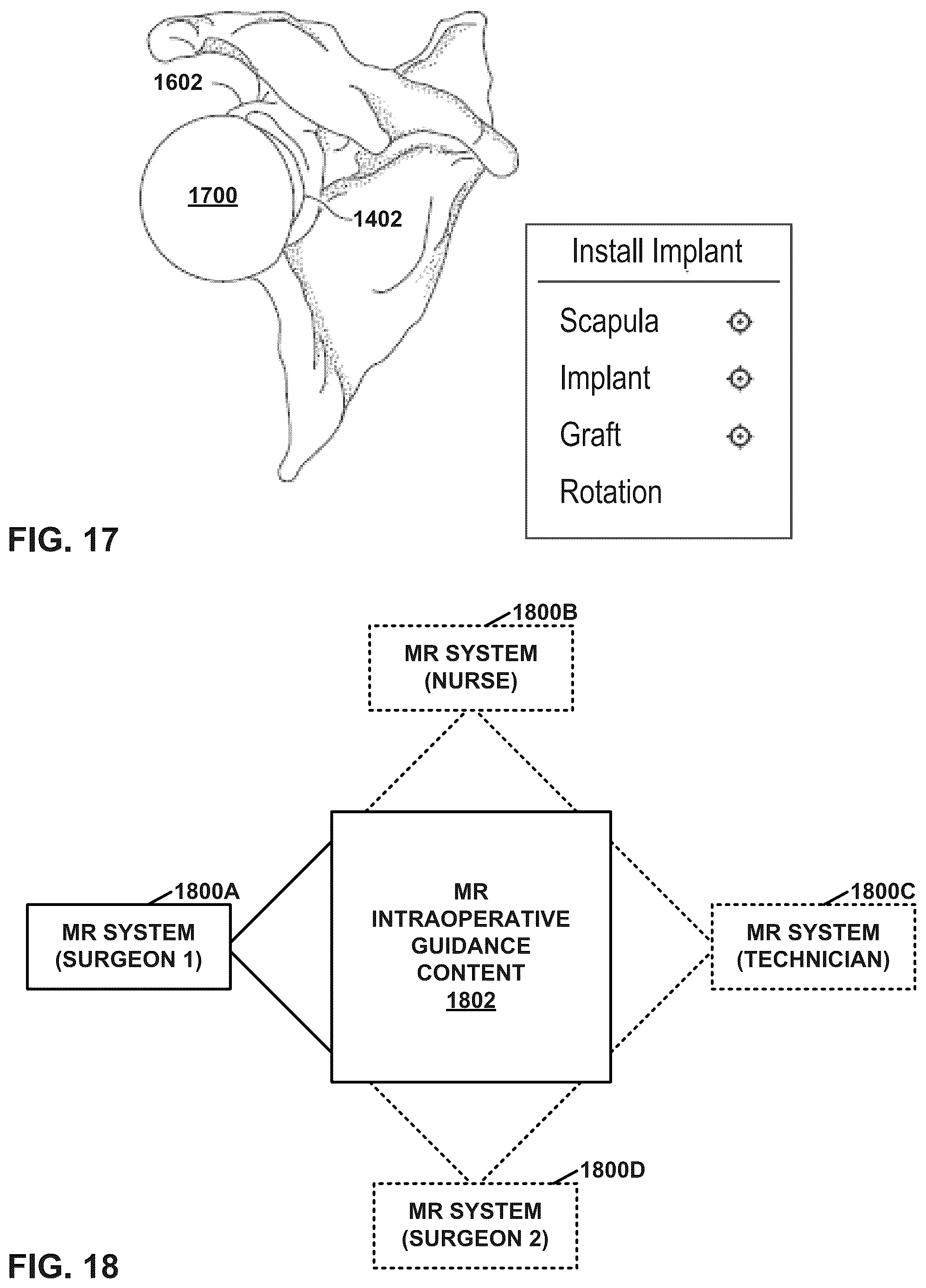 Patent US12112843 Figure 15 – Mixed reality-aided education related to orthopedic surgical procedures