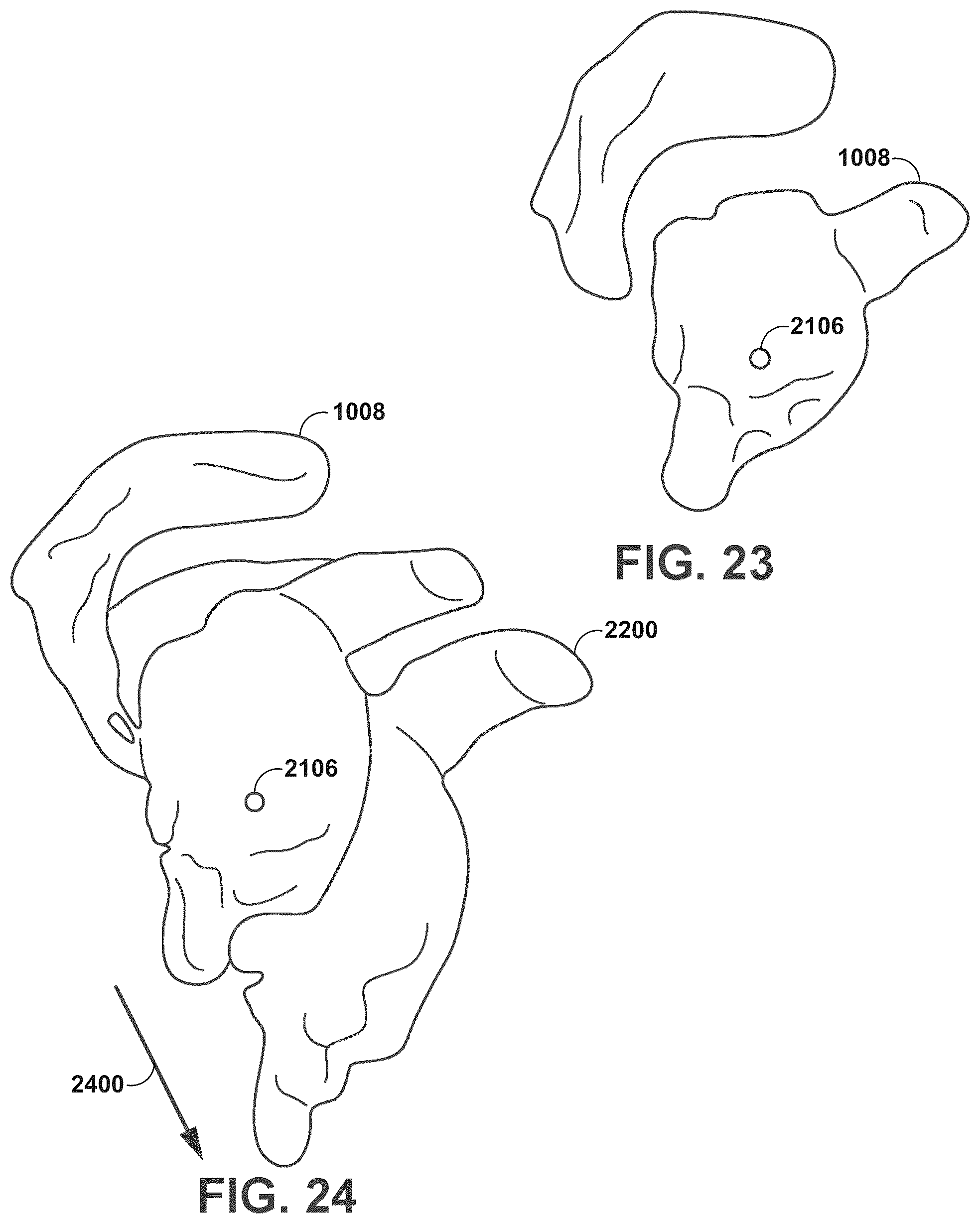 Patent US12112843 Figure 20 – Mixed reality-aided education related to orthopedic surgical procedures