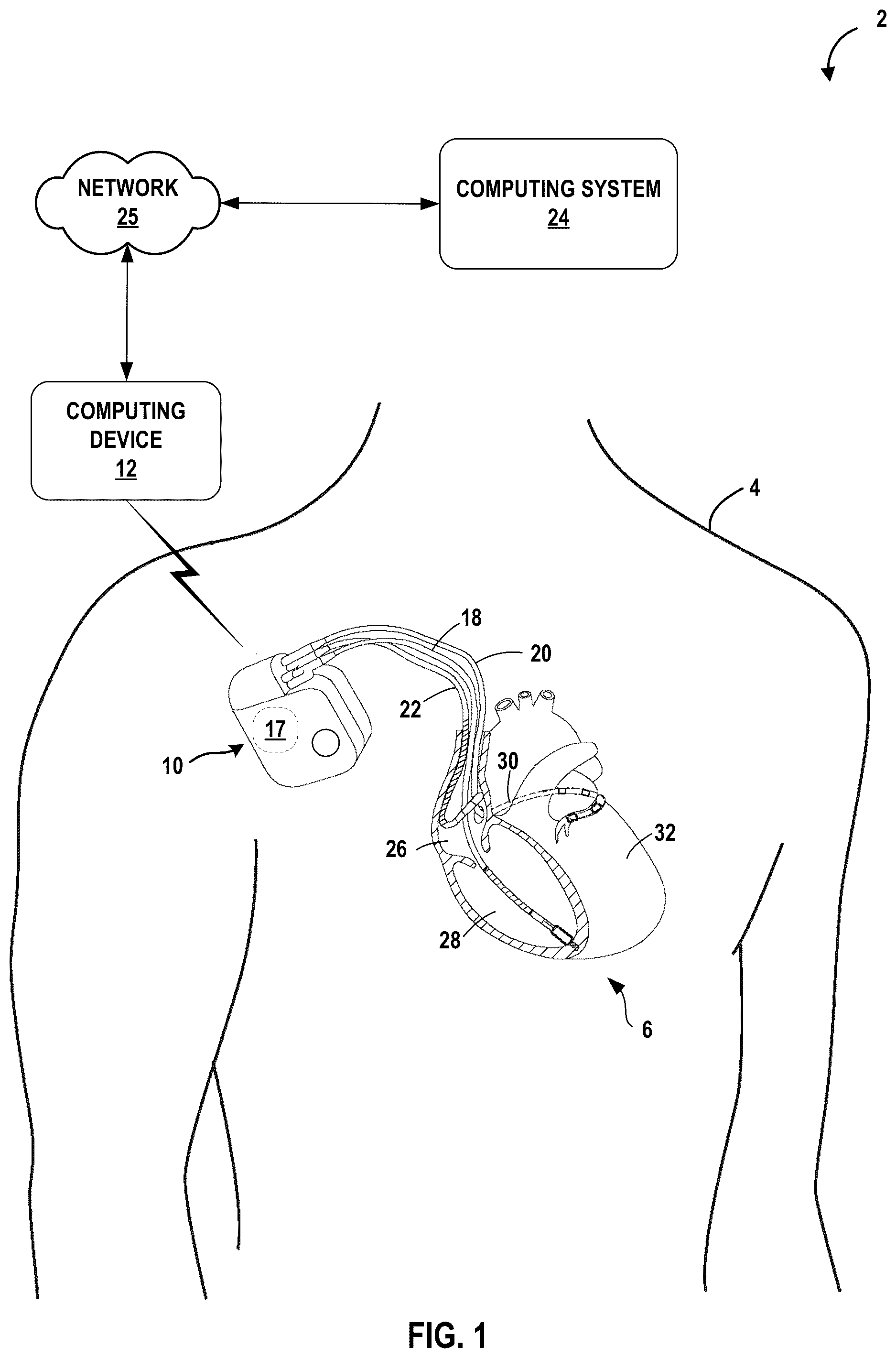 Patent US12112848 — System and method for core-device monitoring — Figure 1