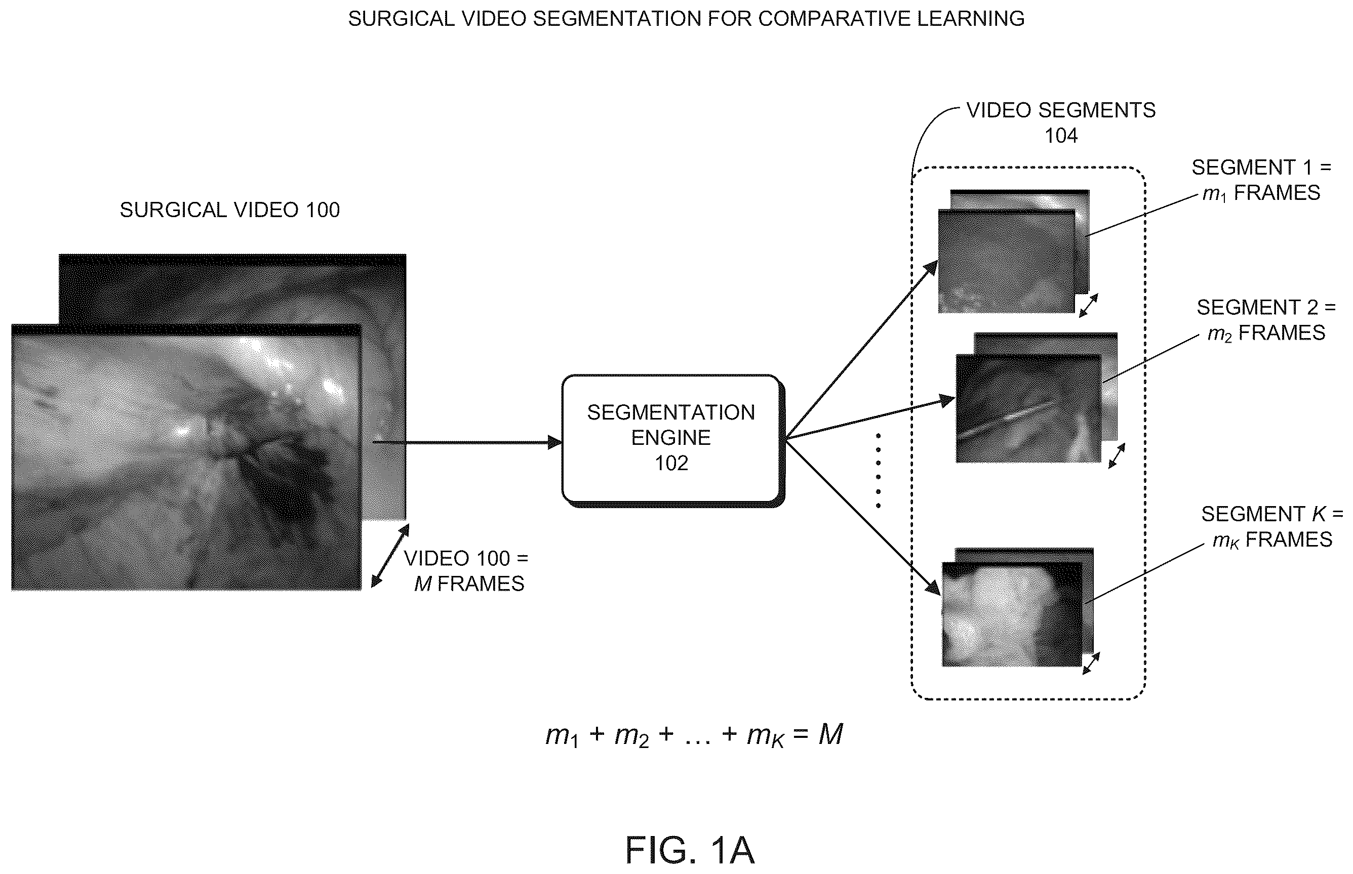 Patent US12120461 — Method and system for synchronizing playback of two recorded videos of the same surgical procedure — Figure 1
