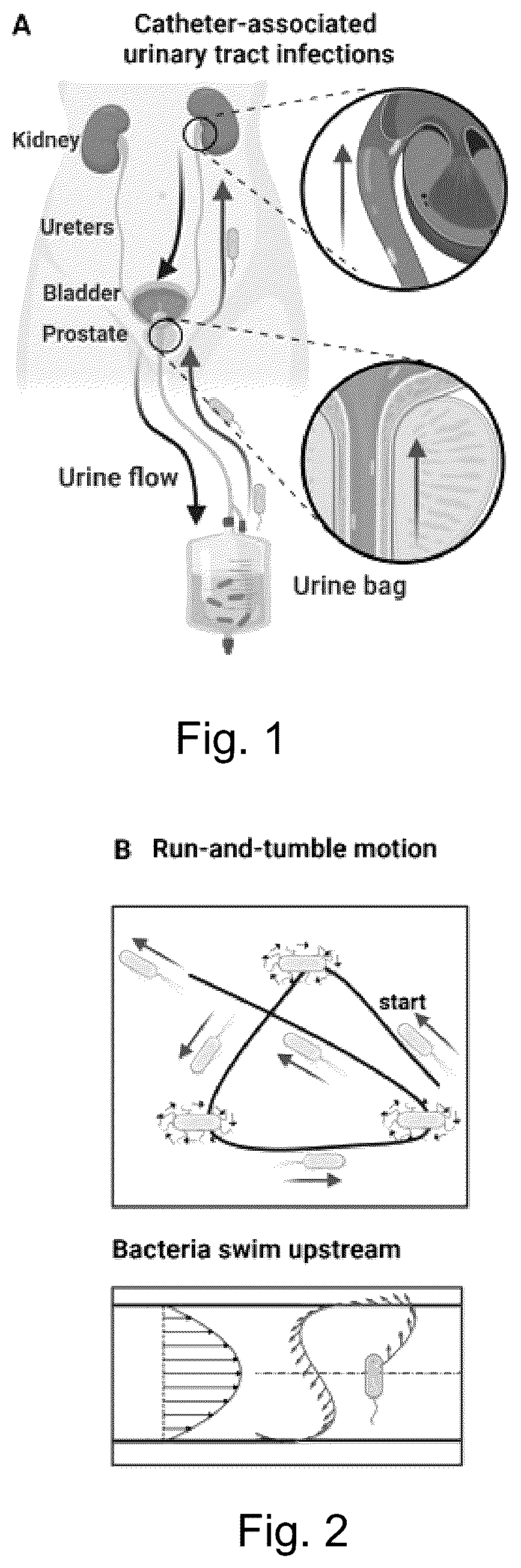 Patent US12128189 — Anti-infection fluidic channel — Figure 1