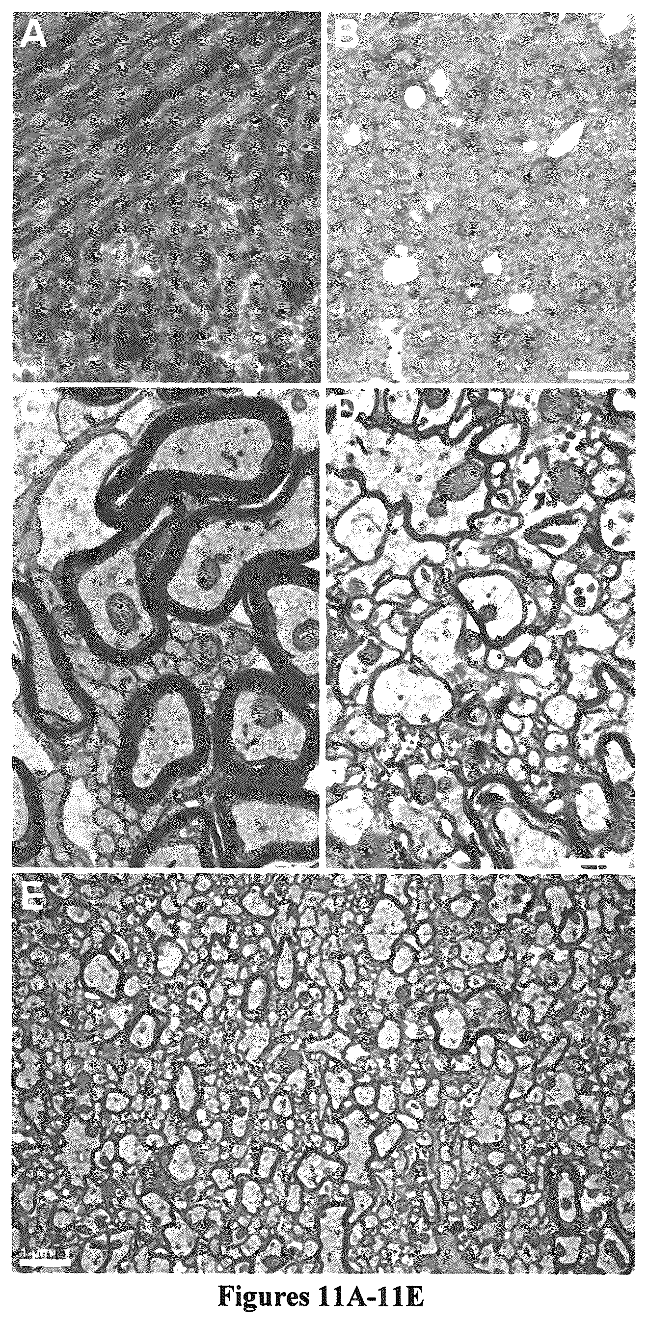Patent US12129484 Figure 12 – Induced pluripotent cell-derived oligodendrocyte progenitor cells for the treatment of myelin disorders