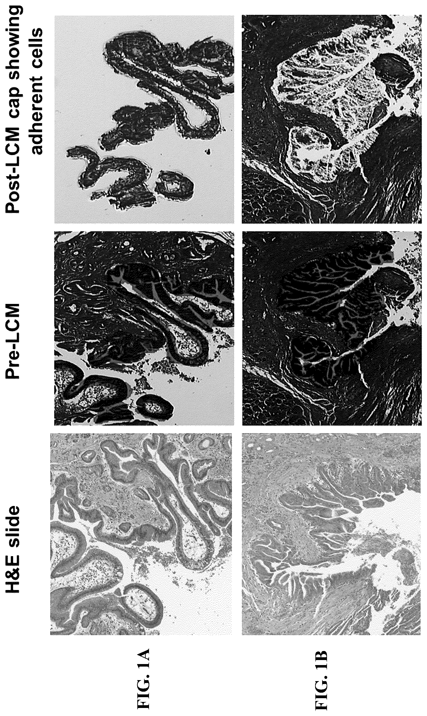Patent US12129522 — MicroRNA assay for detection and management of pancreatic cancer precursors — Figure 1