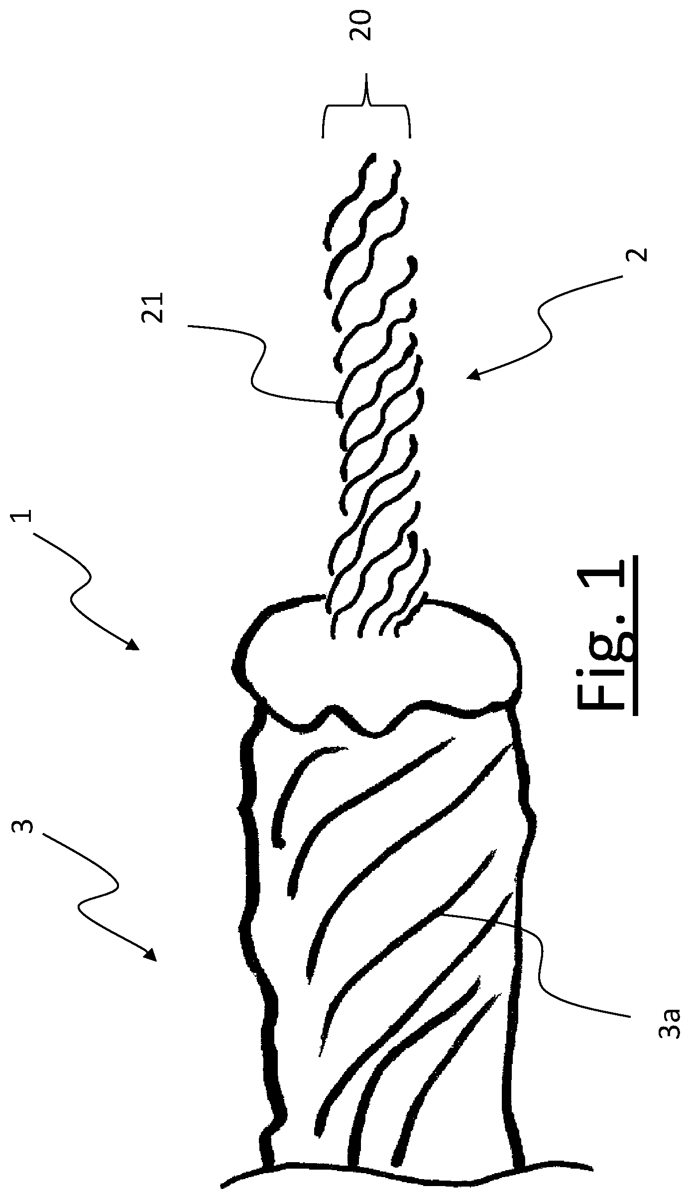 Patent US12134840 — Yarn comprising a core and a sheath — Figure 1